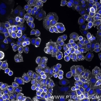 Live SKBR-3 cells immunostained with anti-HER2 (trastuzumab biosimilar) labeled with FlexAble CoraLite Plus 750 Antibody Labeling Kit for Human IgG (KFA107).  Nuclei are in blue.  Epifluorescence images were acquired with a 20x objective and post-processed.