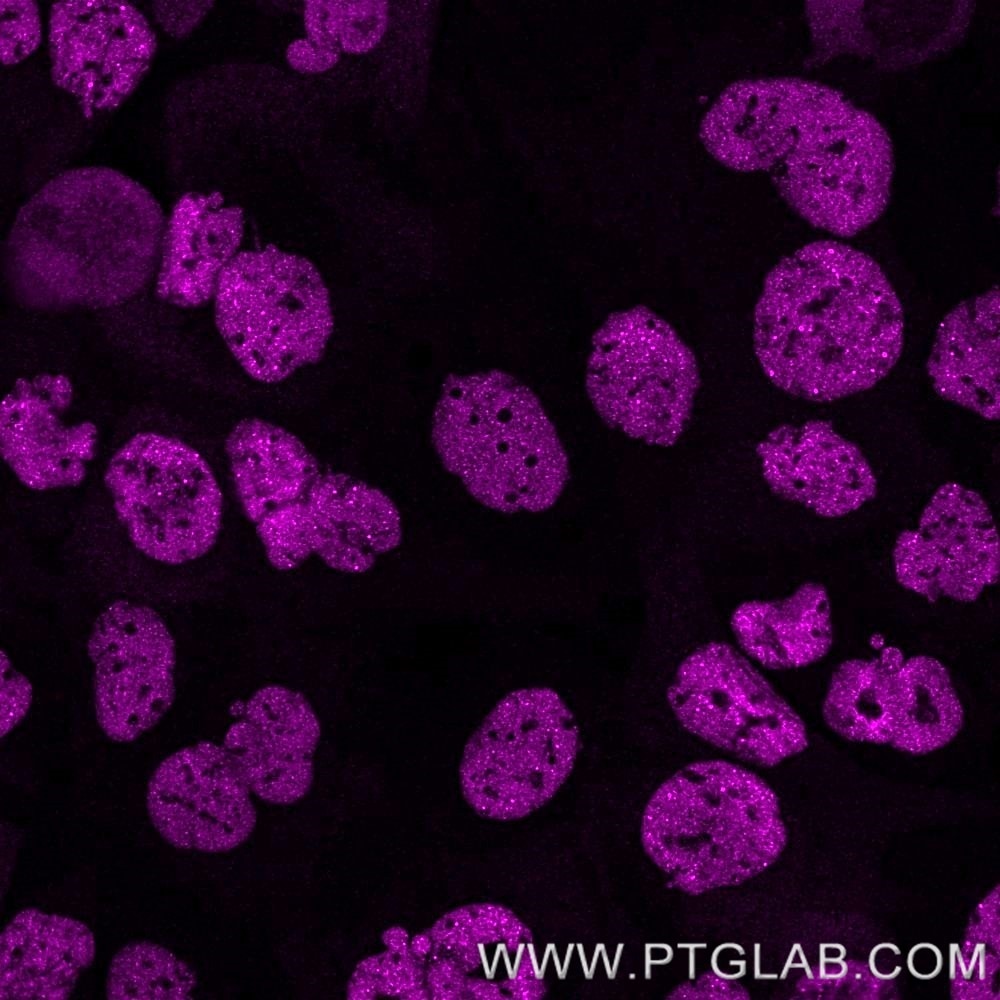 Immunofluorescence of A431 cells: PFA-fixed cells were stained with rat anti-RNA Pol II Ser5 antibody labeled with FlexAble CoraLite® Plus 647 Kit (KFA123, magenta). Confocal images were acquired with a 63x oil objective and post-processed. Images were recorded at the Core Facility Bioimaging at the Biomedical Center, LMU Munich.