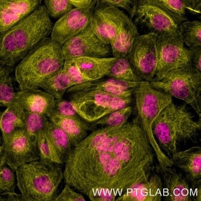 Immunofluorescence of A431: Formaldehyde-fixed A431 cells were stained with rat IgG2b kappa anti-RNA Polymerase II antibody labeled with FlexAble CoraLite® Plus 555 Kit (KFA122, yellow) and rat IgG2a kappa anti-Tubulin antibody labeled with FlexAble CoraLite® Plus 647 Kit (KFA123, magenta). 

Epifluorescence images were acquired with a 20x objective and post-processed.