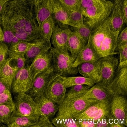 Immunofluorescence of A431: Formaldehyde-fixed A431 cells were stained with rat IgG2a kappa anti-Tubulin antibody labeled with FlexAble CoraLite® Plus 555 Kit (KFA122, yellow) and rat IgG1 kappa anti-RPA32 antibody labeled with FlexAble CoraLite® Plus 647 Kit (KFA123, magenta). 

Epifluorescence images were acquired with a 20x objective and post-processed.