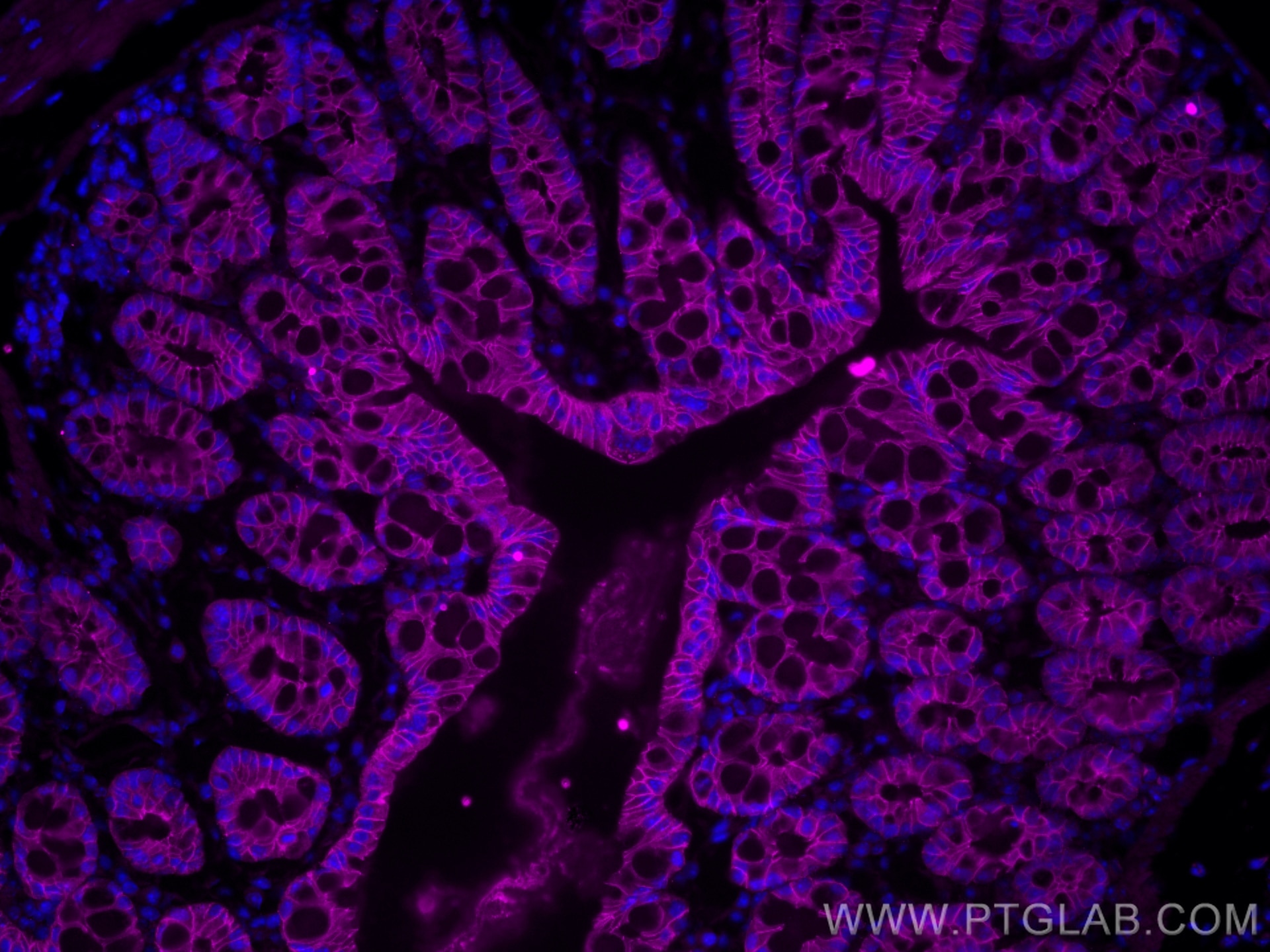 Immunofluorescent analysis of FFPE mouse colon tissue slides with Rat anti-mouse Cdh1 antibody labeled with FlexAble CoraLite Plus 647 Kit (KFA123, magenta). With/without quencher. Cell nuclei were stained with DAPI (blue).