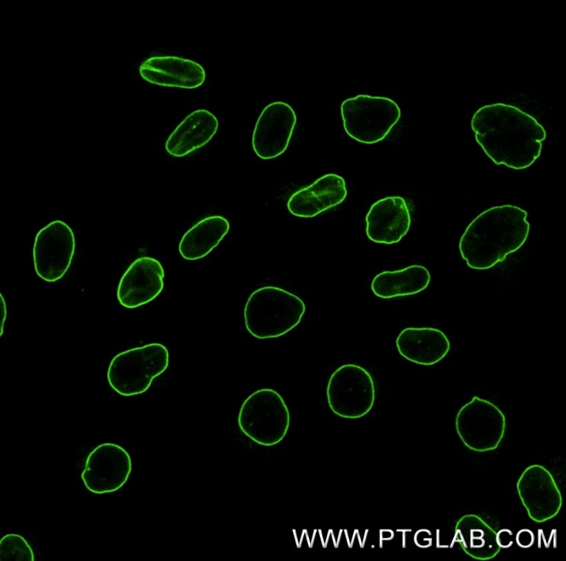 Immunostaining of HeLa cells with rabbit anti-Lamin antibody (12987-1-AP, 1:200, green), which was labeled with a 15-nt DNA oligonucleotide using the KFA151 Kit