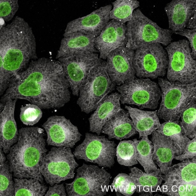 Immunostaining of HeLa cells with mouse IgG2b anti-Tubulin antibodies (66031-1-Ig, 1:100, grey), which was labeled with a 15-nt DNA oligonucleotide using the KFA157 Kit.