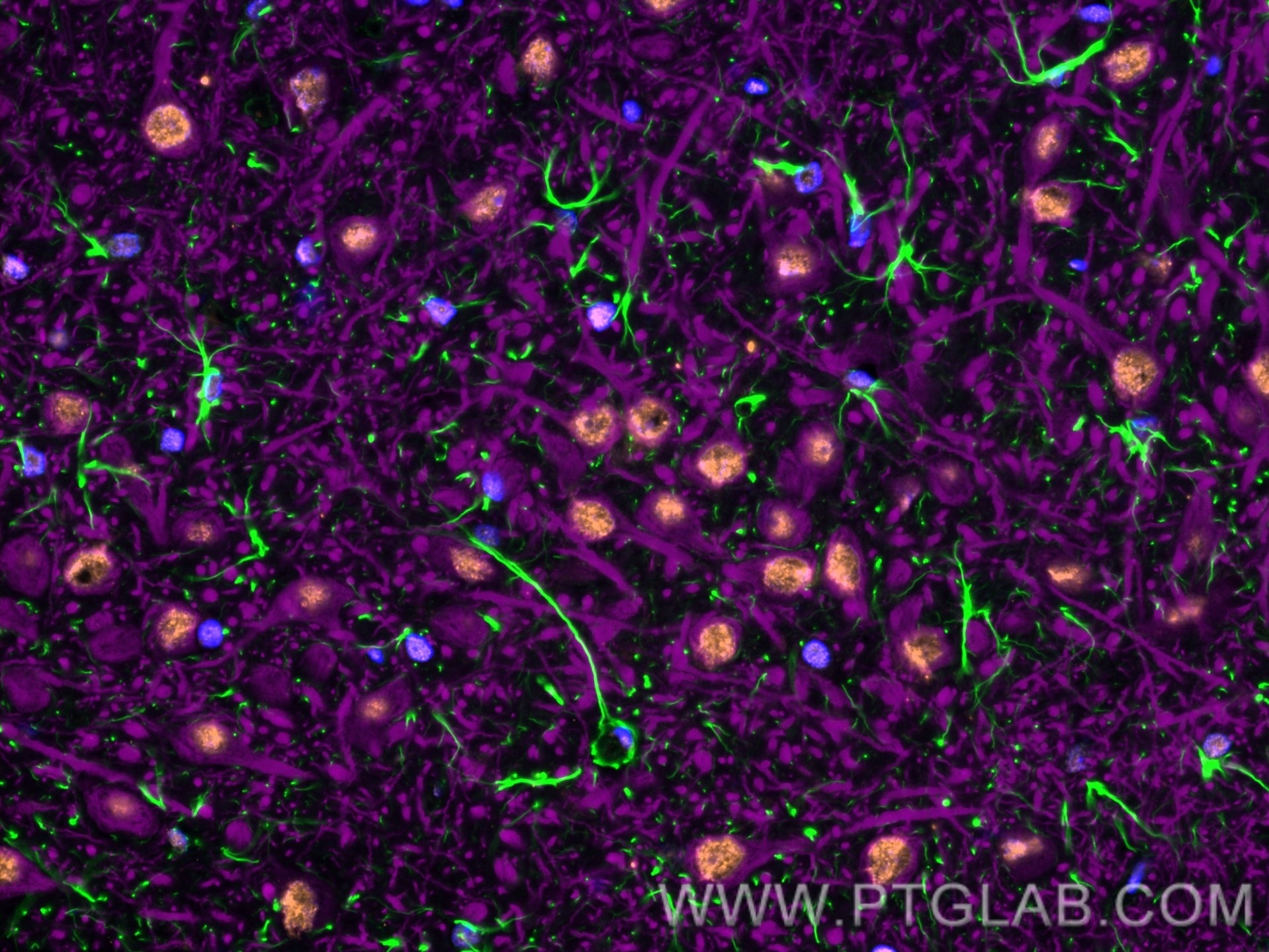 Immunofluorescence of Rat brain: FFPE Rat brain sections were stained with anti-MAP2 (17490-1-AP) labeled with FlexAble 2.0 CoraLite® Plus 647 Kit (KFA503, magenta), anti-GFAP (60190-1-Ig) labeled with FlexAble 2.0 CoraLite® Plus 488 Kit (KFA541, green), anti-TDP-43 (67345-1-Ig) labeled with FlexAble 2.0 CoraLite® Plus 555 Kit (KFA542,organge) and DAPI (blue).
