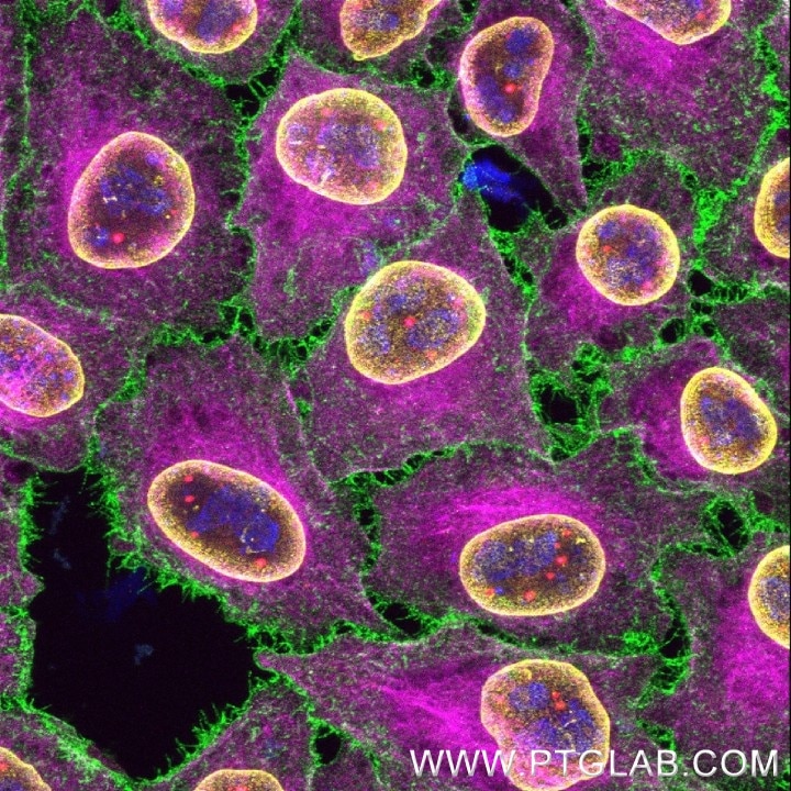 Immunofluorescence of HeLa cells with 5 rabbit primary antibodies: PFA-fixed cells were stained with anti-Ki-67 antibody (MA5-14520, blue) labeled with FlexAble 2.0 CoraLite® Plus 405 Kit (KFA506), anti-CD147 antibody (11989-1-AP, green) labeled with FlexAble 2.0 CoraLite® Plus 488 Kit (KFA501), anti-Lamin B1 antibody (12987-1-AP, yellow) labeled with FlexAble 2.0 CoraLite® Plus 555 Kit (KFA502), anti-Coilin antibody (10967-1-AP, red) labeled with FlexAble 2.0 CoraLite® Plus 647 Kit (KFA503), and anti-Tubulin antibody (80713-1-RR, magenta) labeled with FlexAble 2.0 CoraLite® Plus 800 Kit. Confocal Images were acquired with a 60x oil objective and post-processed.