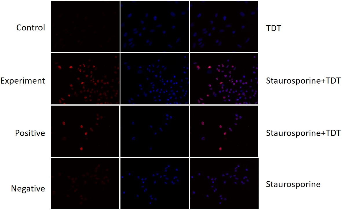 Staurosporine treated HeLa cells for 4 h.