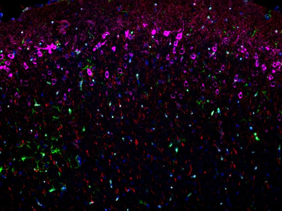 IF staining using PK10032 (Four color TSA Detect Kit for Rabbit/Mouse Primary Antibody). 
FFPE-mouse brain tissue was stained with GFAP recombinant antibody (Cat.NO. 81063-1-RR
) at 1:10000 followed by detection with Multi-rAb® Polymer HRP-Goat Anti-Rabbit/Mouse Universal Recombinant Secondary Antibody (H+L). CoraLite®Plus 488-Tyramide Reagent was used for signal development (green). The slide was then conducted HIER in pH 9.0 Tris-EDTA buffer followed by staining with MAP2 Polyclonal antibody (17490-1-AP, 1:10000). CoraLite®Plus 594-Tyramide Reagent were used for signal development (red). Similarly, WFS1 Polyclonal antibody (26995-1-AP, 1:5000) was stained subsequently. CoraLite®Plus 647-Tyramide Reagent were used for signal development (purple). Finally, cell nucleus (blue) were stained with DAPI. The signal from each channel was captured and merged. The secondaries and Tyramide reagents, as well as DAPI are all from the kit.