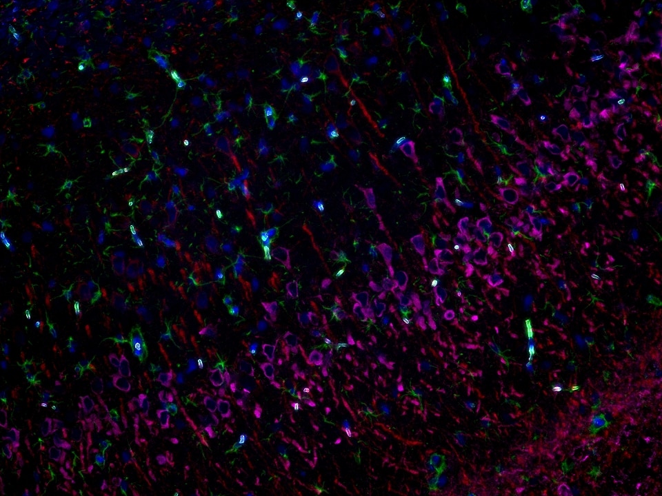IF staining using PK10032 (Four color TSA Detect Kit for Rabbit/Mouse Primary Antibody). 
FFPE-rat brain tissue was stained with GFAP recombinant antibody (Cat.NO. 81063-1-RR) at 1:10000 followed by detection with Multi-rAb® Polymer HRP-Goat Anti-Rabbit/Mouse Universal Recombinant Secondary Antibody (H+L). CoraLite®Plus 488-Tyramide Reagent  was used for signal development (green). The slide was then conducted HIER in pH 9.0 Tris-EDTA buffer followed by staining with MAP2 Polyclonal antibody (17490-1-AP, 1:10000). CoraLite®Plus 594-Tyramide Reagent were used for signal development (red). Similarly, WFS1 Polyclonal antibody (26995-1-AP, 1:5000) was stained subsequently. CoraLite®Plus 647-Tyramide Reagent were used for signal development (purple). Finally, cell nucleus (blue) were stained with DAPI. The signal from each channel was captured and merged. The secondaries and Tyramide reagents, as well as DAPI are all from the kit.