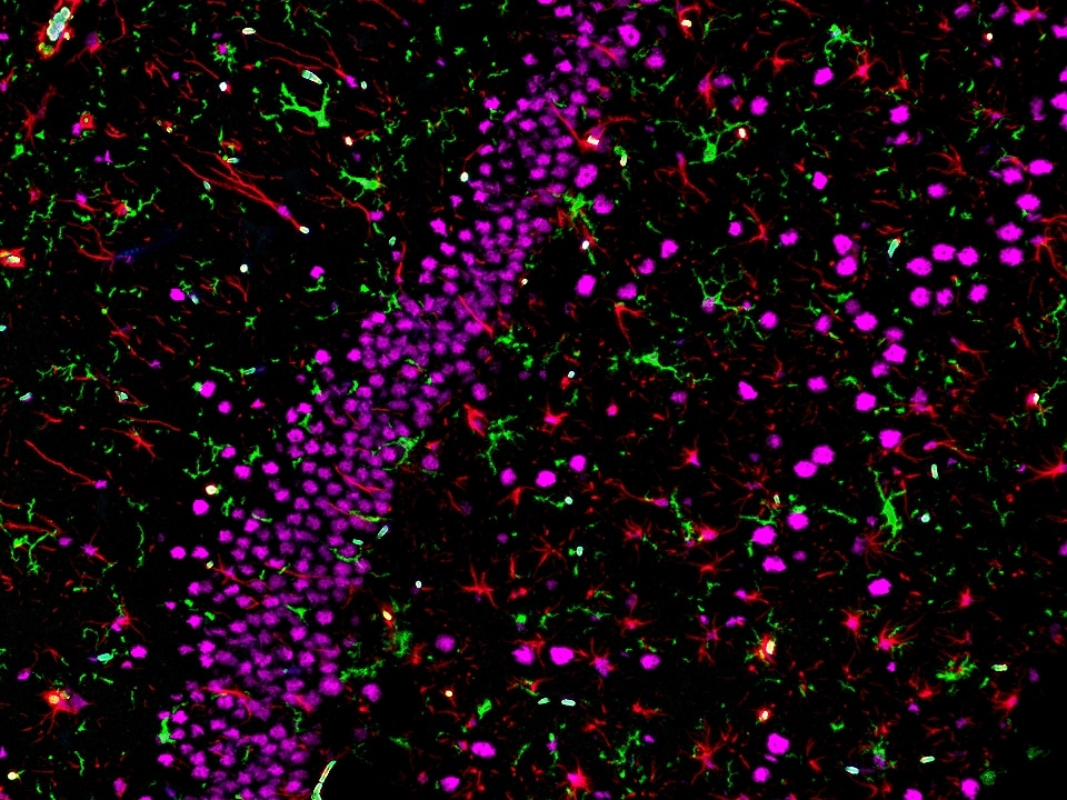 IF staining using PK10032 (Four color TSA Detect Kit for Rabbit/Mouse Primary Antibody). 
FFPE-rat brain tissue was stained with IBA1 recombinant antibody (Cat.NO. 81728-1-RR ) at 1:2000 followed by detection with Multi-rAb® Polymer HRP-Goat Anti-Rabbit/Mouse Universal Recombinant Secondary Antibody (H+L). CoraLite®Plus 488-Tyramide Reagent was used for signal development (green). The slide was then conducted HIER in pH 9.0 Tris-EDTA buffer followed by staining with GFAP monoclonal antibody (60190-1-Ig, 1:20000). CoraLite®Plus 594-Tyramide Reagent were used for signal development (red). Similarly, TDP-43 recombinant antibody (80002-1-RR, 1:3200) was stained subsequently. CoraLite®Plus 647-Tyramide Reagent were used for signal development (purple). Finally, cell nucleus (blue) were stained with DAPI. The signal from each channel was captured and merged. The secondaries and Tyramide reagents, as well as DAPI are all from the kit.