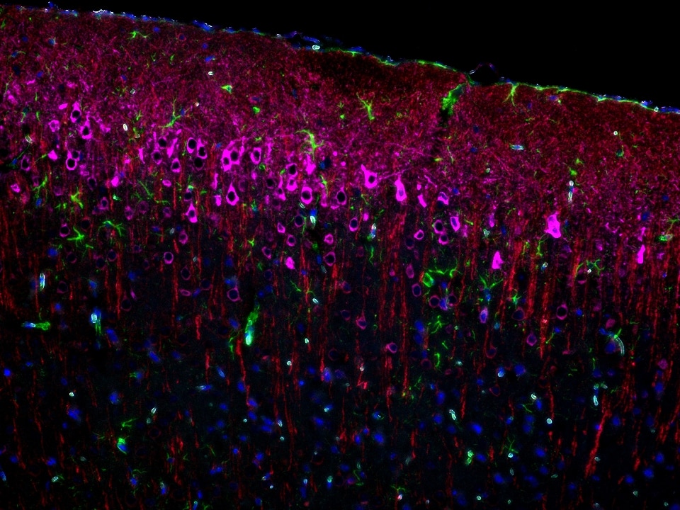 IF staining using PK10033 (Four Detect Kit for Rabbit Primary Antibody). 
FFPE-mouse brain tissue was stained with GFAP recombinant antibody (Cat.NO. 81063-1-RR) at 1:10000 followed by detection with Multi-rAb® Polymer HRP-Goat Anti-Rabbit Recombinant Secondary Antibody (H+L). CoraLite®Plus 488-Tyramide Reagent was used for signal development (green). The slide was then conducted HIER in pH 9.0 Tris-EDTA buffer followed by staining with MAP2 Polyclonal antibody (17490-1-AP, 1:10000). CoraLite®Plus 594-Tyramide Reagent was used for signal development (red). Similarly, WFS1 Polyclonal antibody (26995-1-AP, 1:5000) was stained subsequently. CoraLite®Plus 647-Tyramide Reagent was used for signal development (purple). Finally, cell nucleus (blue) were stained with DAPI. The signal from each channel was captured and merged. The secondaries and Tyramide reagents, as well as DAPI are all from the kit.