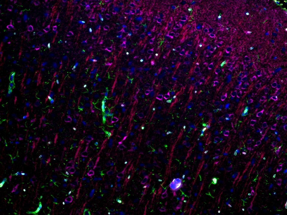 IF staining using PK10033 (Four Detect Kit for Rabbit Primary Antibody). 
FFPE-mouse brain tissue was stained with GFAP recombinant antibody (Cat.NO. 81063-1-RR) at 1:10000 followed by detection with Multi-rAb® Polymer HRP-Goat Anti-Rabbit Recombinant Secondary Antibody (H+L). CoraLite®Plus 488-Tyramide Reagent  was used for signal development (green). The slide was then conducted HIER in pH 9.0 Tris-EDTA buffer followed by staining with MAP2 Polyclonal antibody (17490-1-AP, 1:10000). CoraLite®Plus 594-Tyramide Reagent were used for signal development (red). Similarly, WFS1 Polyclonal antibody (26995-1-AP, 1:5000) was stained subsequently. CoraLite®Plus 647-Tyramide Reagent were used for signal development (purple). Finally, cell nucleus (blue) were stained with DAPI. The signal from each channel was captured and merged. The secondaries and Tyramide reagents, as well as DAPI are all from the kit.