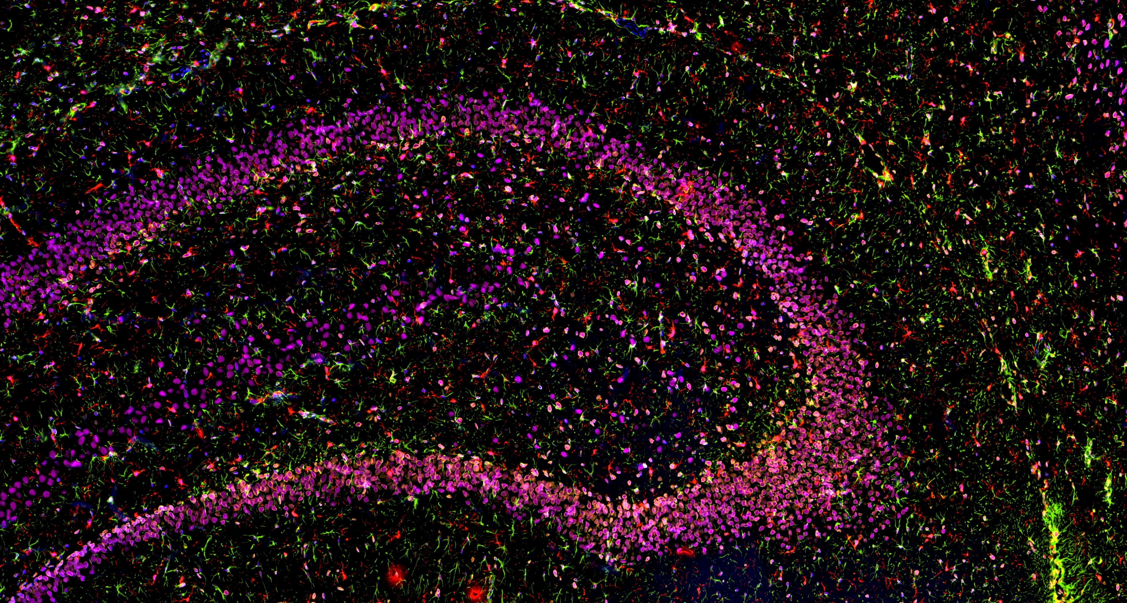 IF staining using PK10034 (Five color TSA Detect Kit for Rabbit/Mouse Primary Antibody).
FFPE-rat brain tissue was stained with Lamin B1 monoclonal antibody (Cat.NO. 66095-1-Ig) at 1:2000 followed by detection with Multi-rAb® Polymer HRP-Goat Anti-Rabbit/Mouse Universal Recombinant Secondary Antibody (H+L). CoraLite®Plus 555-Tyramide Reagent was used for signal development (yellow). The slide was then conducted HIER in pH 9.0 Tris-EDTA buffer followed by staining with GFAP monoclonal antibody (60190-1-Ig, 1:20000). CoraLite®Plus 488-Tyramide Reagent were used for signal development (green). Similarly, IBA1 recombinant antibody (81728-1-RR, 1:2000) TDP-43 recombinant antibody (80002-1-RR, 1:3200) were stained subsequently. CoraLite®Plus 594-Tyramide Reagent (red) and CoraLite®Plus 647-Tyramide Reagent (purple) were used for signal development respectively. Finally, cell nucleus (blue) were stained with DAPI. The signal from each channel was captured and merged.