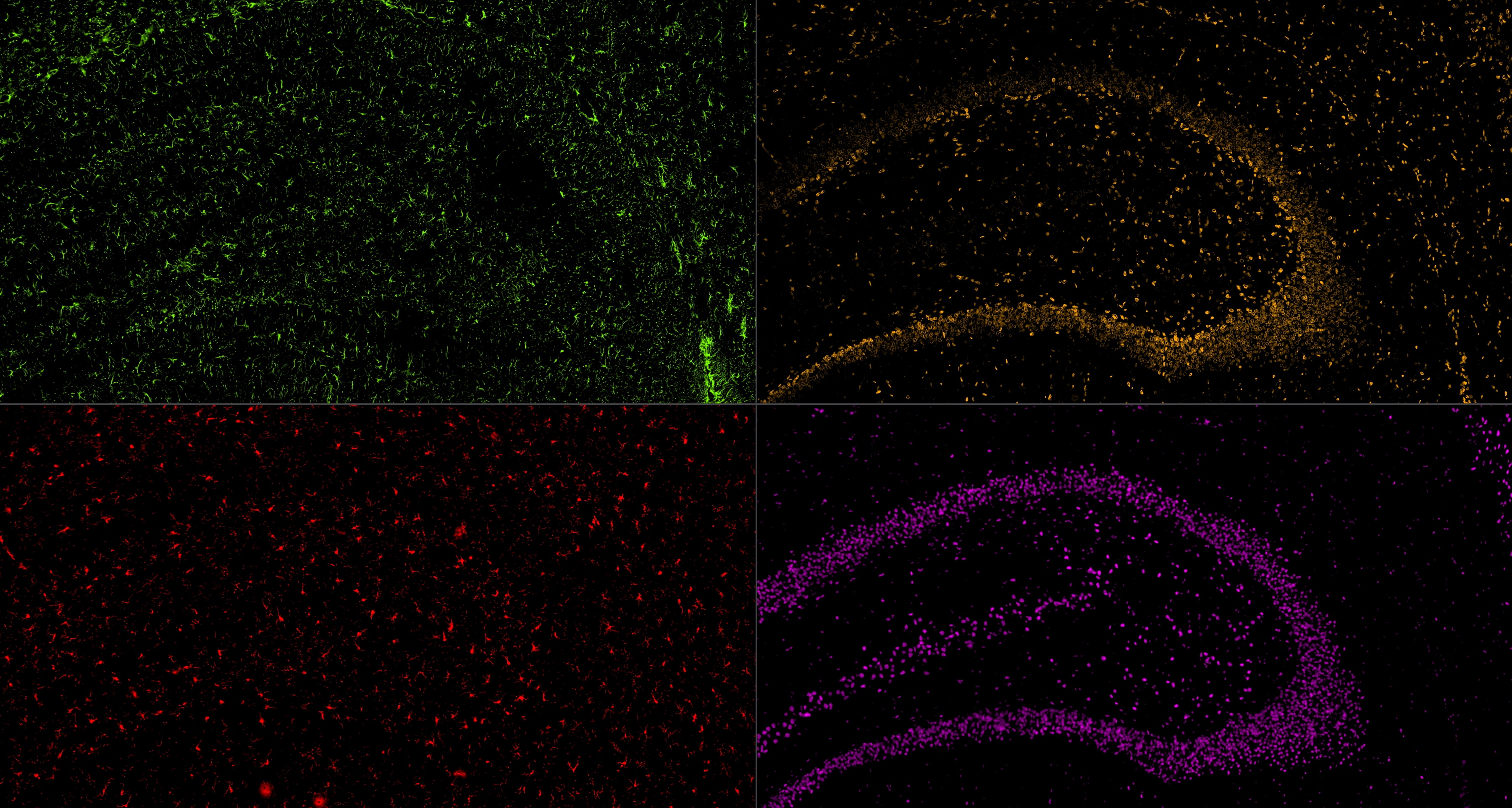 IF staining using PK10034 (Five color TSA Detect Kit for Rabbit/Mouse Primary Antibody).
FFPE-rat brain tissue was stained with Lamin B1 monoclonal antibody (Cat.NO. 66095-1-Ig) at 1:2000 followed by detection with Multi-rAb® Polymer HRP-Goat Anti-Rabbit/Mouse Universal Recombinant Secondary Antibody (H+L). CoraLite®Plus 555-Tyramide Reagent was used for signal development (yellow). The slide was then conducted HIER in pH 9.0 Tris-EDTA buffer followed by staining with GFAP monoclonal antibody (60190-1-Ig, 1:20000). CoraLite®Plus 488-Tyramide Reagent were used for signal development (green). Similarly, IBA1 recombinant antibody (81728-1-RR, 1:2000) TDP-43 recombinant antibody (80002-1-RR, 1:3200) were stained subsequently. CoraLite®Plus 594-Tyramide Reagent (red) and CoraLite®Plus 647-Tyramide Reagent (purple) were used for signal development respectively. Finally, cell nucleus (blue) were stained with DAPI.