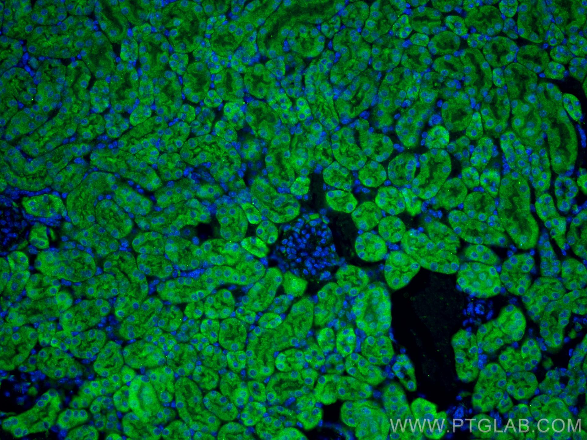 Immunofluorescent analysis of (4% PFA) fixed mouse kidney tissue using DHODH antibody (14877-1-AP) at dilution of 1:200 and CoraLite®488-Conjugated AffiniPure Goat Anti-Rabbit IgG(H+L).