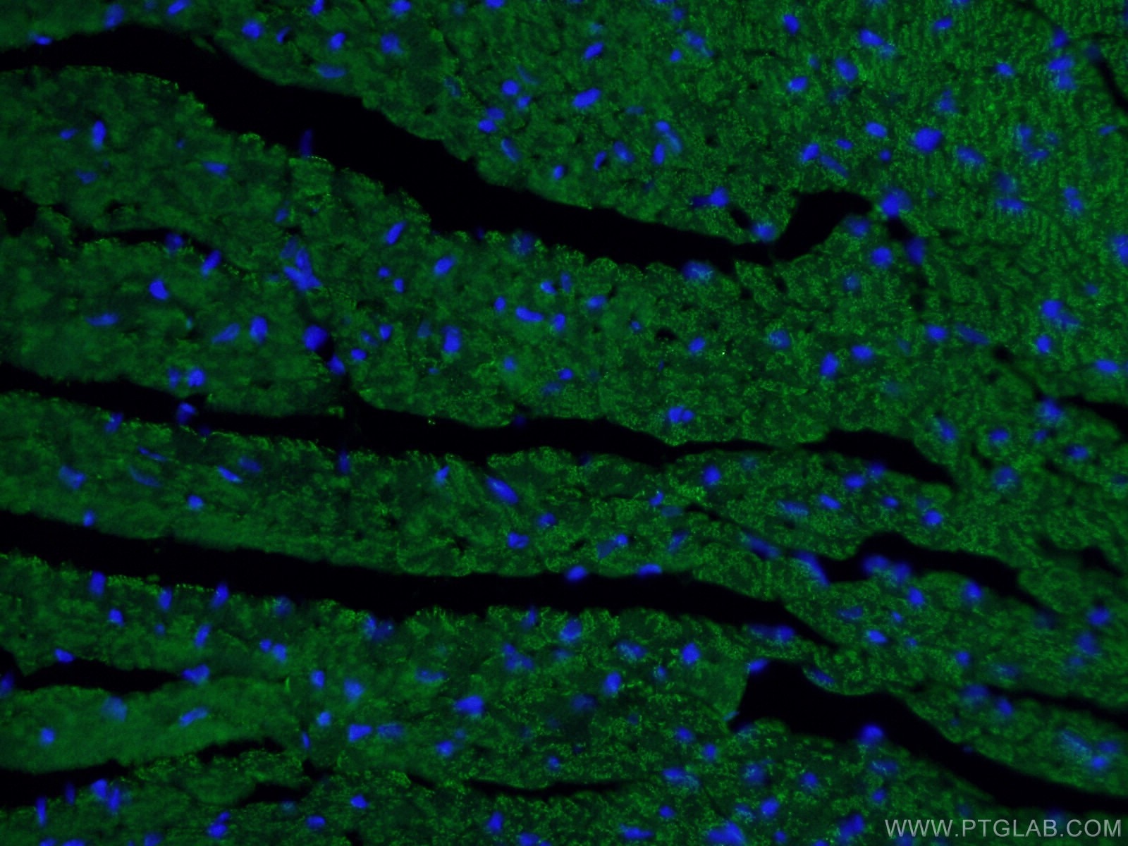 Immunofluorescent analysis of (4% PFA) fixed mouse heart tissue using 66665-1-Ig (Beclin 1 antibody) at dilution of 1:100 and Alexa Fluor 488-Conjugated AffiniPure Goat Anti-Mouse IgG(H+L).