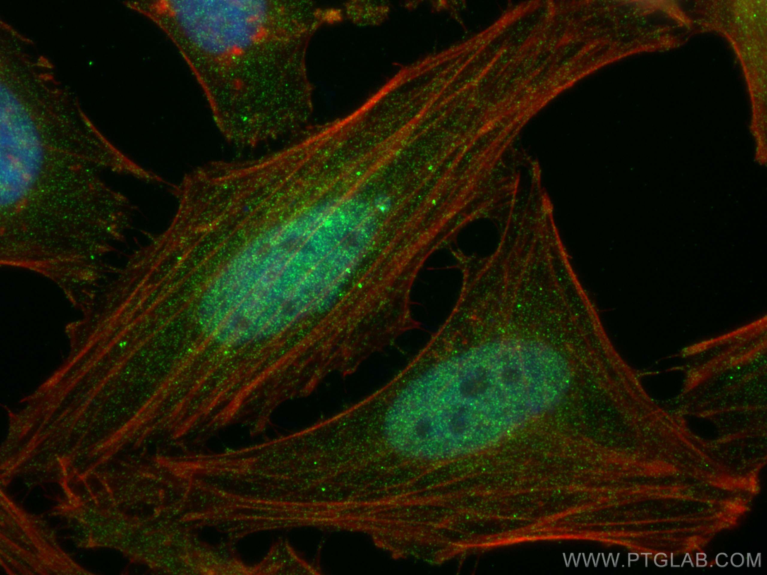 Immunofluorescent analysis of (4% PFA) fixed HeLa cells using ubiquitin antibody (80992-1-RR, Clone: 6H6 ) at dilution of 1:1000 and CoraLite®488-Conjugated AffiniPure Goat Anti-Rabbit IgG(H+L), CL594-phalloidin (red).