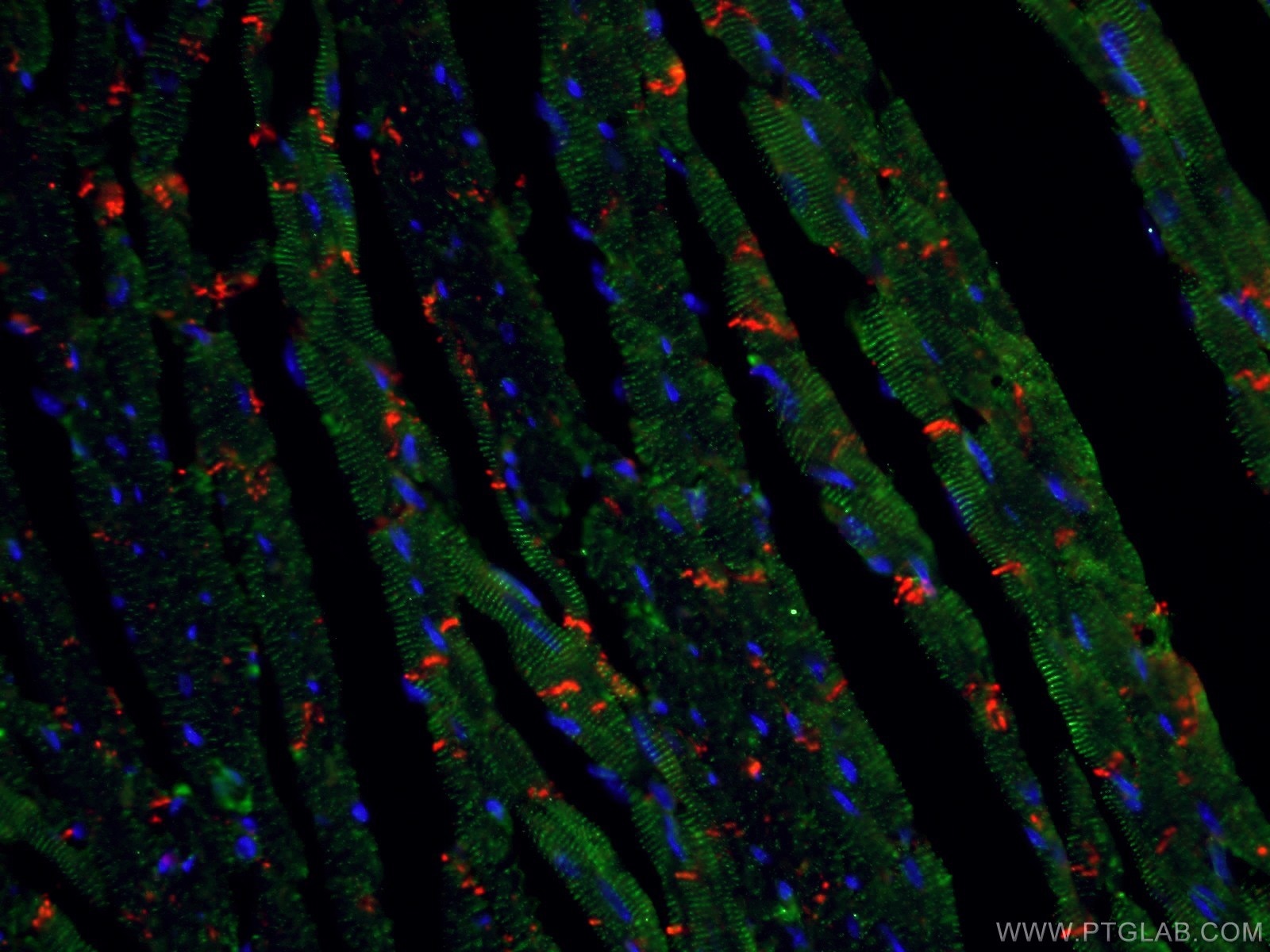 Immunofluorescent analysis of (4% PFA) fixed mouse heart tissue using 66219-1-Ig (N-cadherin antibody) at dilution of 1:100 and CoraLite594-Conjugated AffiniPure Goat Anti-Mouse IgG(H+L). The section was co-stained with 11313-2-AP (alpha Actinin) in green.