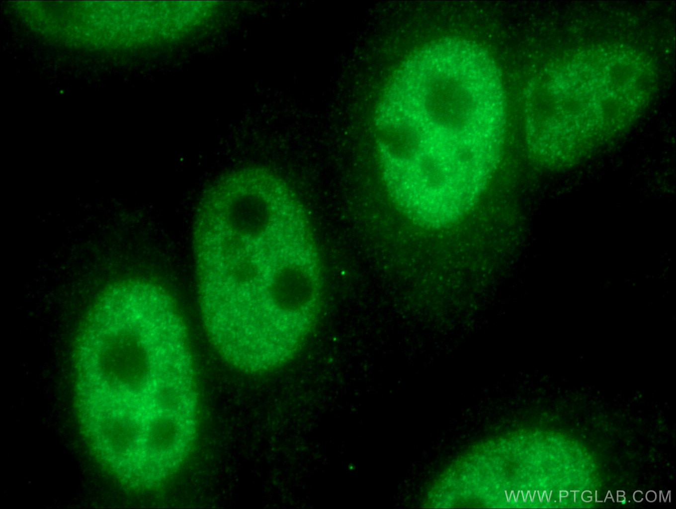 Immunofluorescent analysis of (4% PFA) fixed HepG2 cells using 25465-1-AP (TWIST1-specific antibody) at dilution of 1:50 and Alexa Fluor 488-Conjugated AffiniPure Goat Anti-Rabbit IgG(H+L).