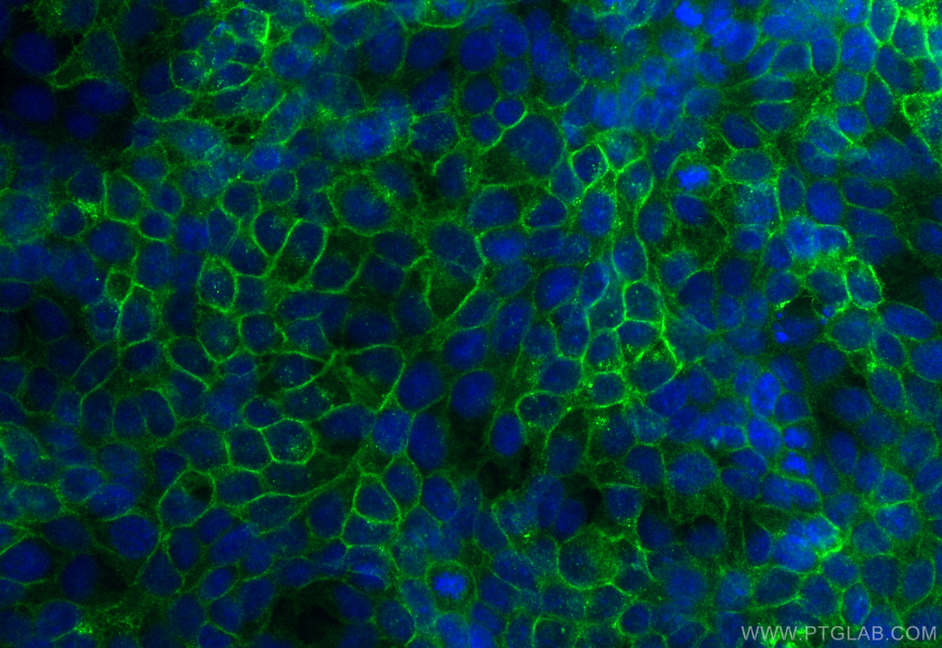 Immunofluorescent analysis of (4% PFA) fixed HUVEC cells using Claudin 1 antibody (13050-1-AP) at dilution of 1:2000 and CoraLite®488-Conjugated AffiniPure Goat Anti-Rabbit IgG(H+L), Alpha Tubulin antibody (66031-1-Ig, Clone: 1E4C11, red).