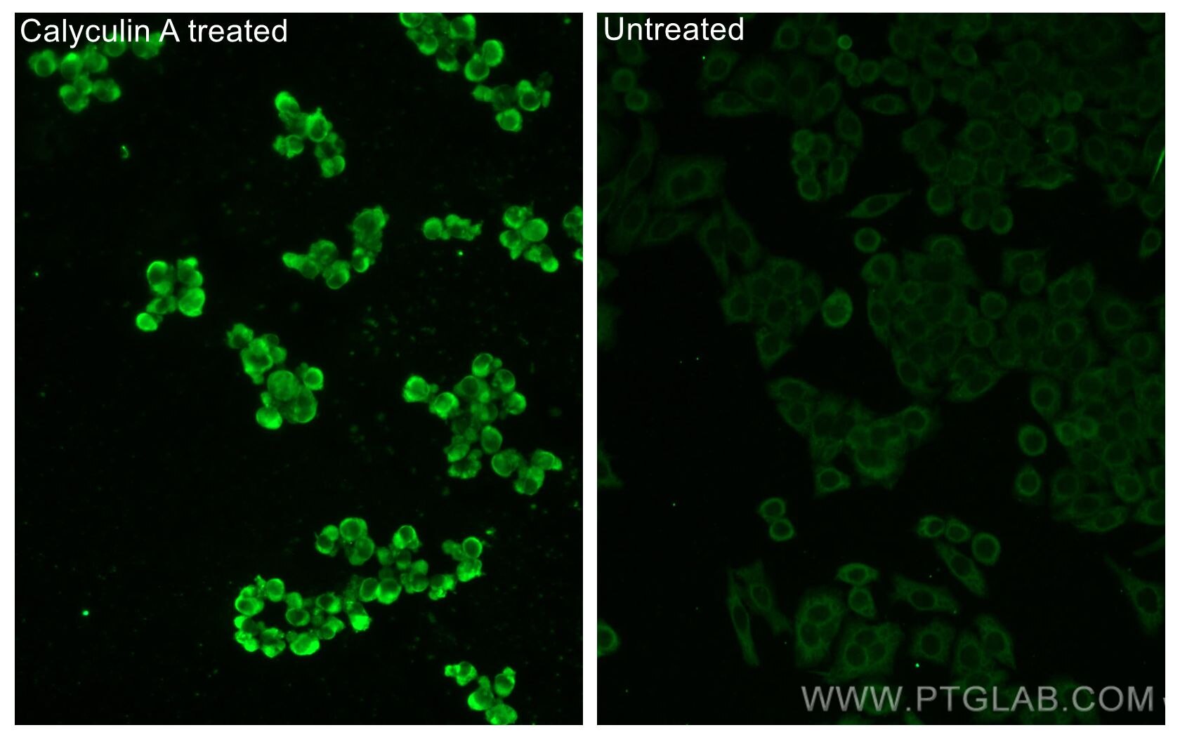 Immunofluorescent analysis of (-20°C Ethanol) fixed Calyculin A treated PC-3 cells and non-treated PC-3 cells using Phospho-GSK3B (Ser9) antibody (67558-1-Ig, Clone: 1C9E2 ) at dilution of 1:200 and CoraLite®488-Conjugated Goat Anti-Mouse IgG(H+L).