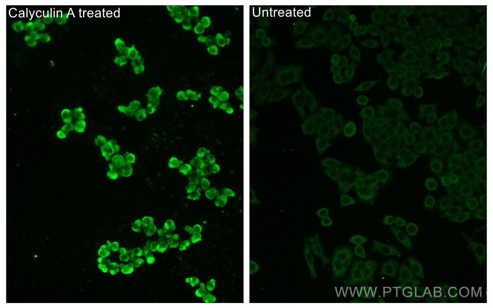 Immunofluorescent analysis of (-20°C Ethanol) fixed Calyculin A treated PC-3 cells and non-treated PC-3 cells using Phospho-GSK3B (Ser9) antibody (67558-1-Ig, Clone: 1C9E2 ) at dilution of 1:200 and CoraLite®488-Conjugated Goat Anti-Mouse IgG(H+L).
