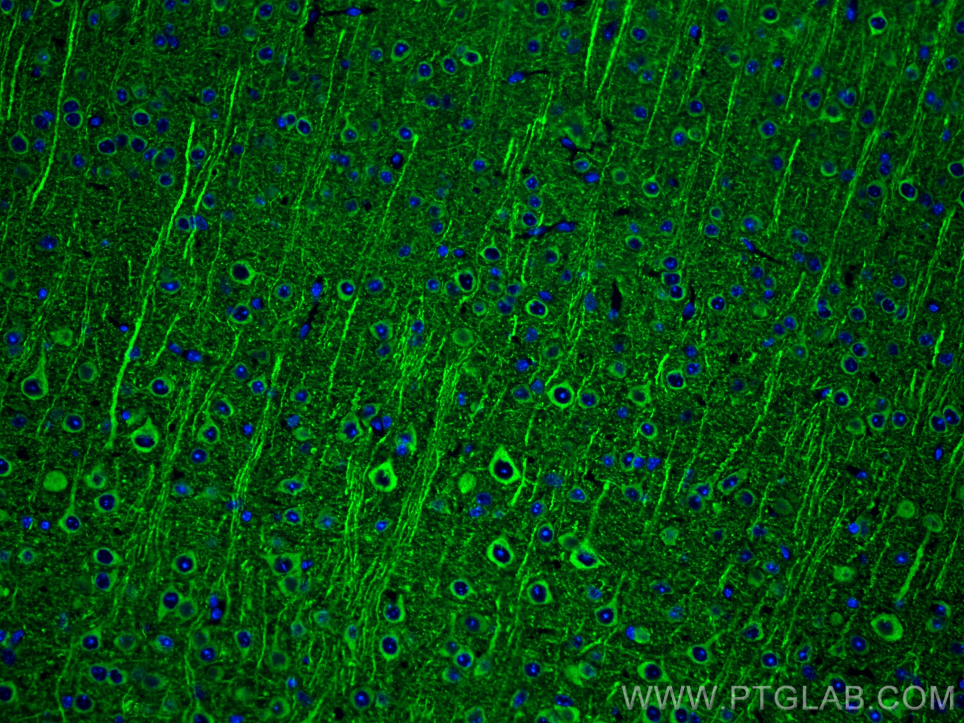 Immunofluorescent analysis of (4% PFA) fixed mouse brain tissue using MAP2 antibody (17490-1-AP) at dilution of 1:200 and CoraLite®488-Conjugated AffiniPure Goat Anti-Rabbit IgG(H+L).