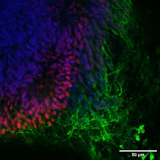 Retinal organoids (day 30) generated from human induced pluripotent stem cells (iPSCs) and fixed with 4% PFA. Stained for Tubulin beta 3/TUJ1 using 66375-1-Ig at 1:500 dilution (green) and PAX6 (12323-1-AP) at 1:500. Nuclear stain DAPI (blue). Scale bar = 50 µm. Data generated by Alessandro Bellapianta at Johannes Kepler Universitat, Austria. 