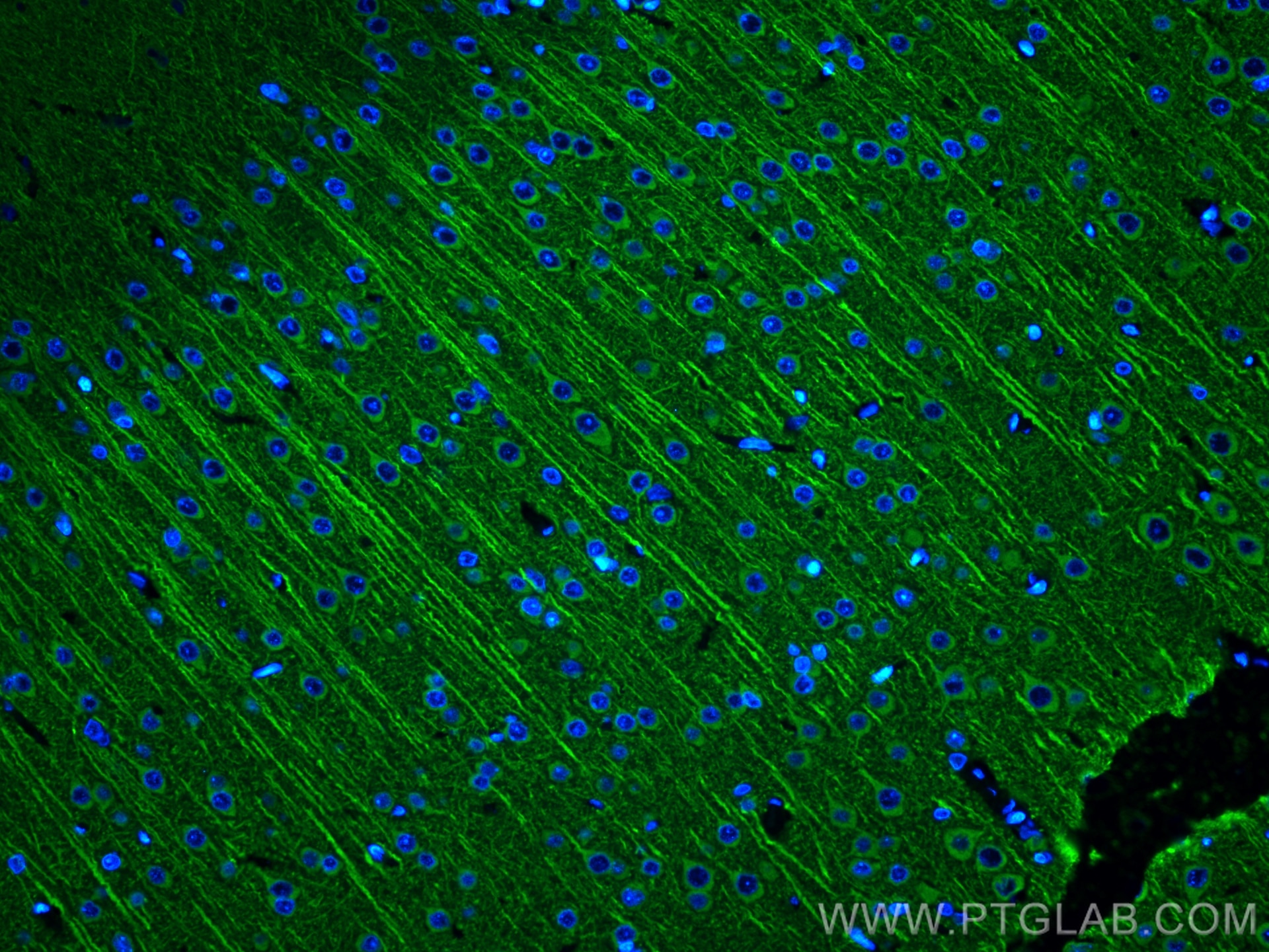 Immunofluorescent analysis of (4% PFA) fixed rat brain tissue using MAP2 antibody (17490-1-AP) at dilution of 1:200 and CoraLite®488-Conjugated AffiniPure Goat Anti-Rabbit IgG(H+L).