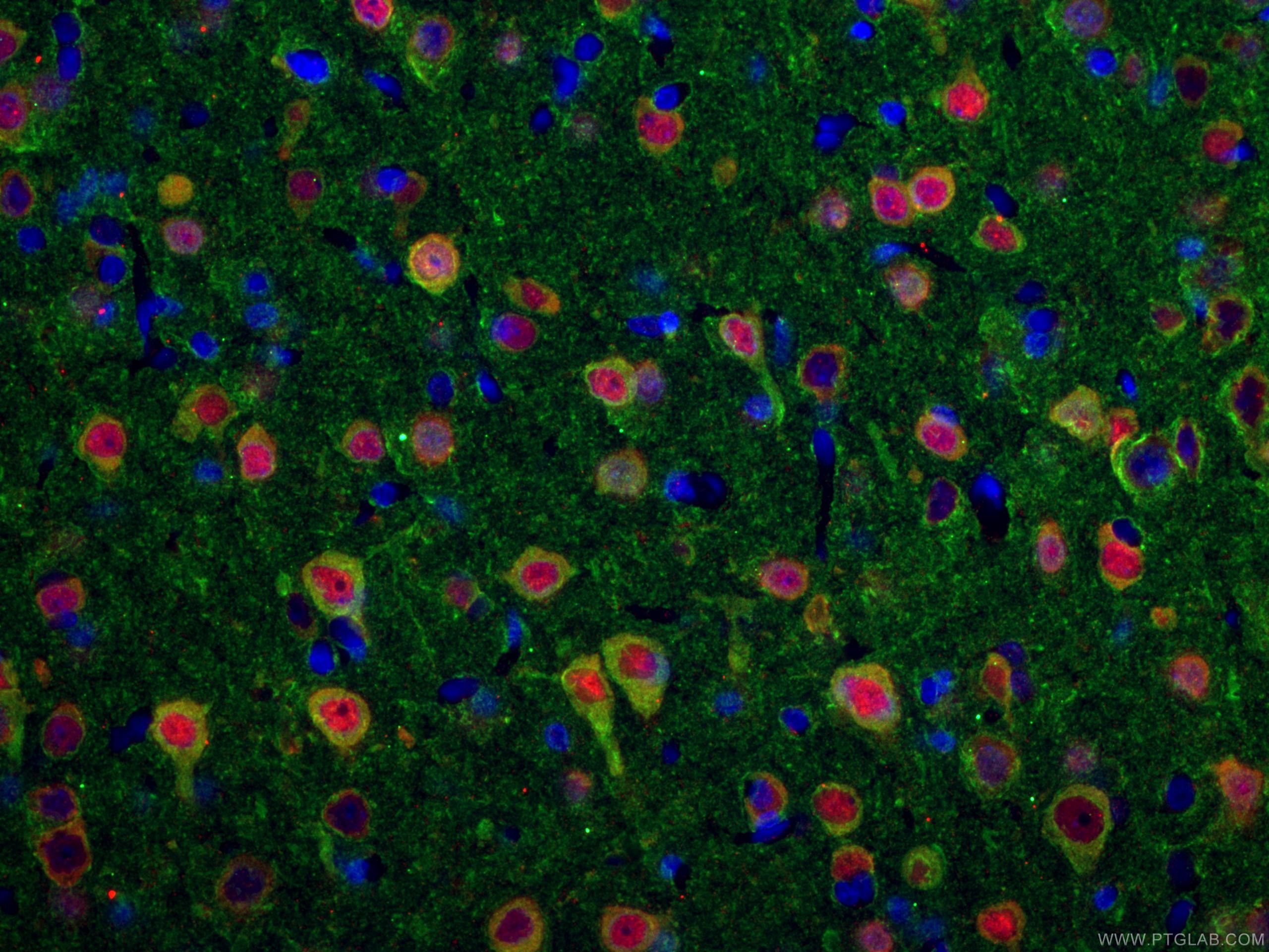 Immunofluorescent analysis of (4% PFA) fixed rat brain tissue using 66375-1-Ig (TUBB3-specific antibody), at dilution of 1:200 and CoraLite®488-Conjugated AffiniPure Goat Anti-Mouse IgG(H+L). The section was co-stained with 26975-1-AP (NeuN antibody, red).
