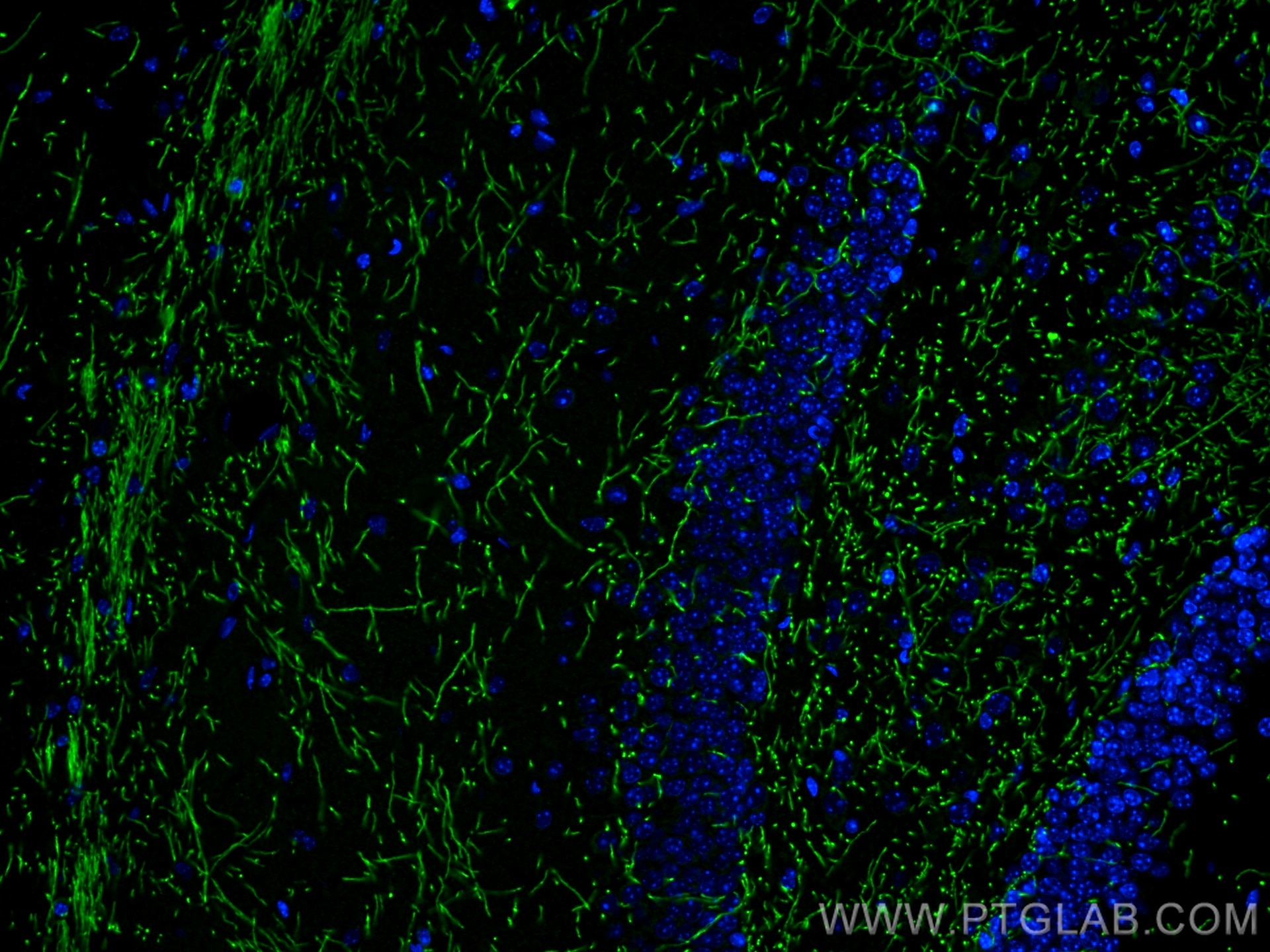 Immunofluorescent analysis of (4% PFA) fixed mouse brain tissue using Myelin basic protein antibody (10458-1-AP) at dilution of 1:200 and CoraLite®488-Conjugated AffiniPure Goat Anti-Rabbit IgG(H+L).