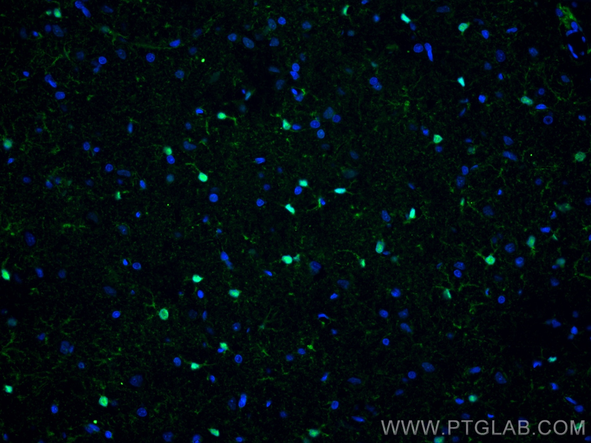 Immunofluorescent analysis of (4% PFA) fixed rat brain tissue using S100 Beta antibody (66616-1-Ig, Clone: 1G10F4 ) at dilution of 1:400 and CoraLite®488-Conjugated AffiniPure Goat Anti-Mouse IgG(H+L).