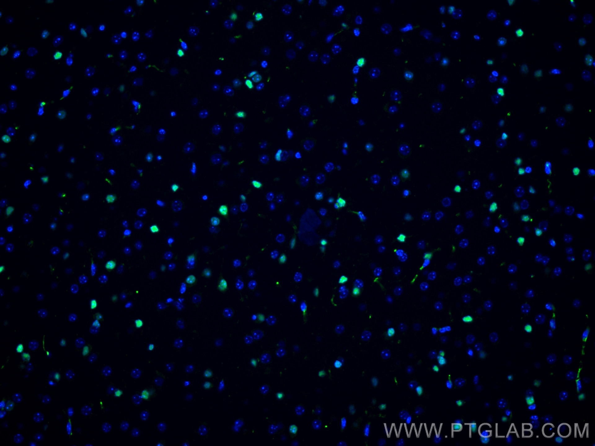 Immunofluorescent analysis of (4% PFA) fixed mouse brain tissue using SOX2 antibody (66411-1-Ig, Clone: 4B9B10 ) at dilution of 1:1000 and CoraLite®488-Conjugated AffiniPure Goat Anti-Mouse IgG(H+L).