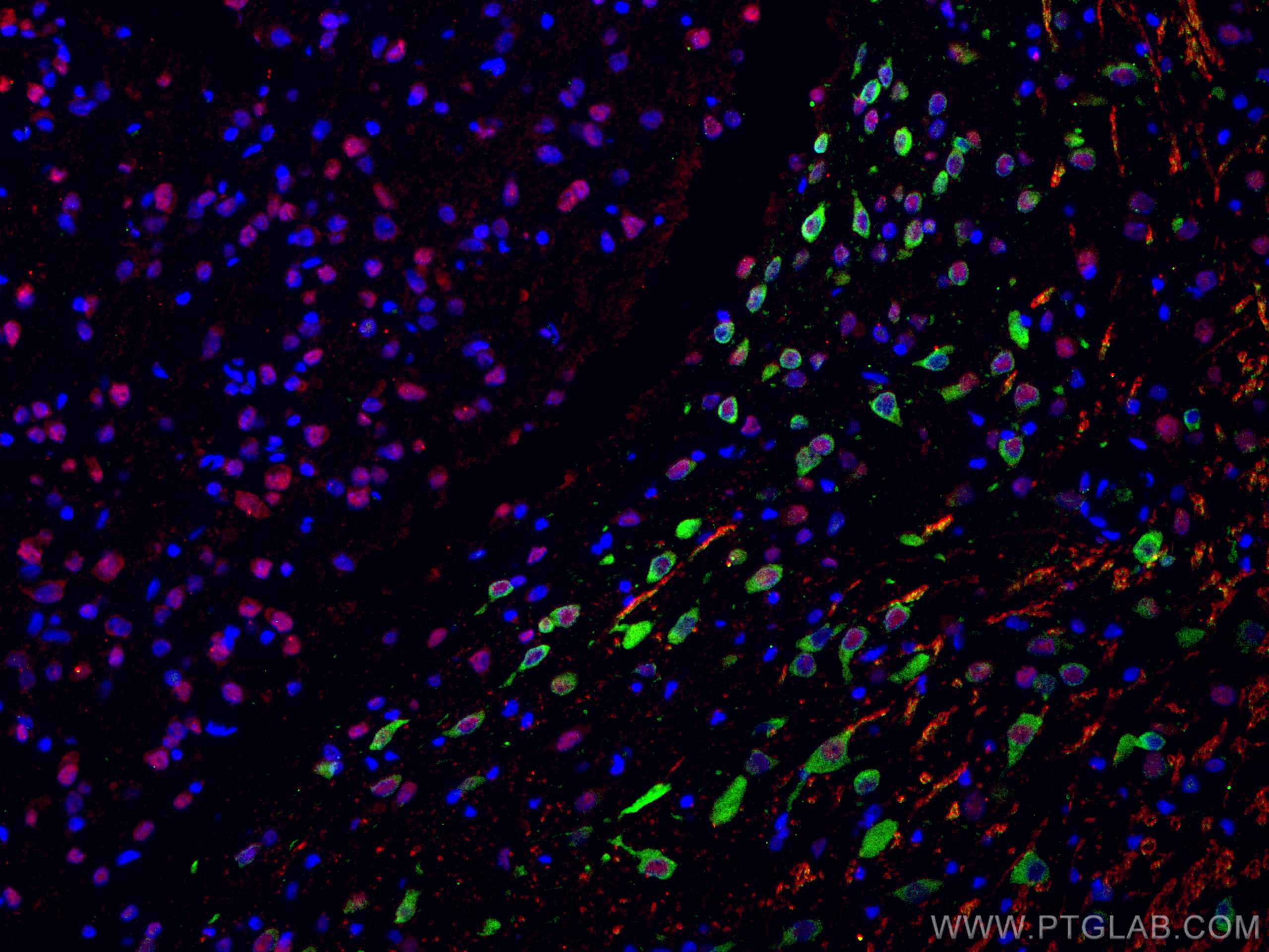 Immunofluorescent analysis of (4% PFA) fixed rat brain tissue using nestin antibody (29285-1-AP) at dilution of 1:200 and CoraLite®488-Conjugated AffiniPure Goat Anti-Rabbit IgG(H+L), NeuN antibody (66836-1-Ig, Clone: 3A4C1, red).