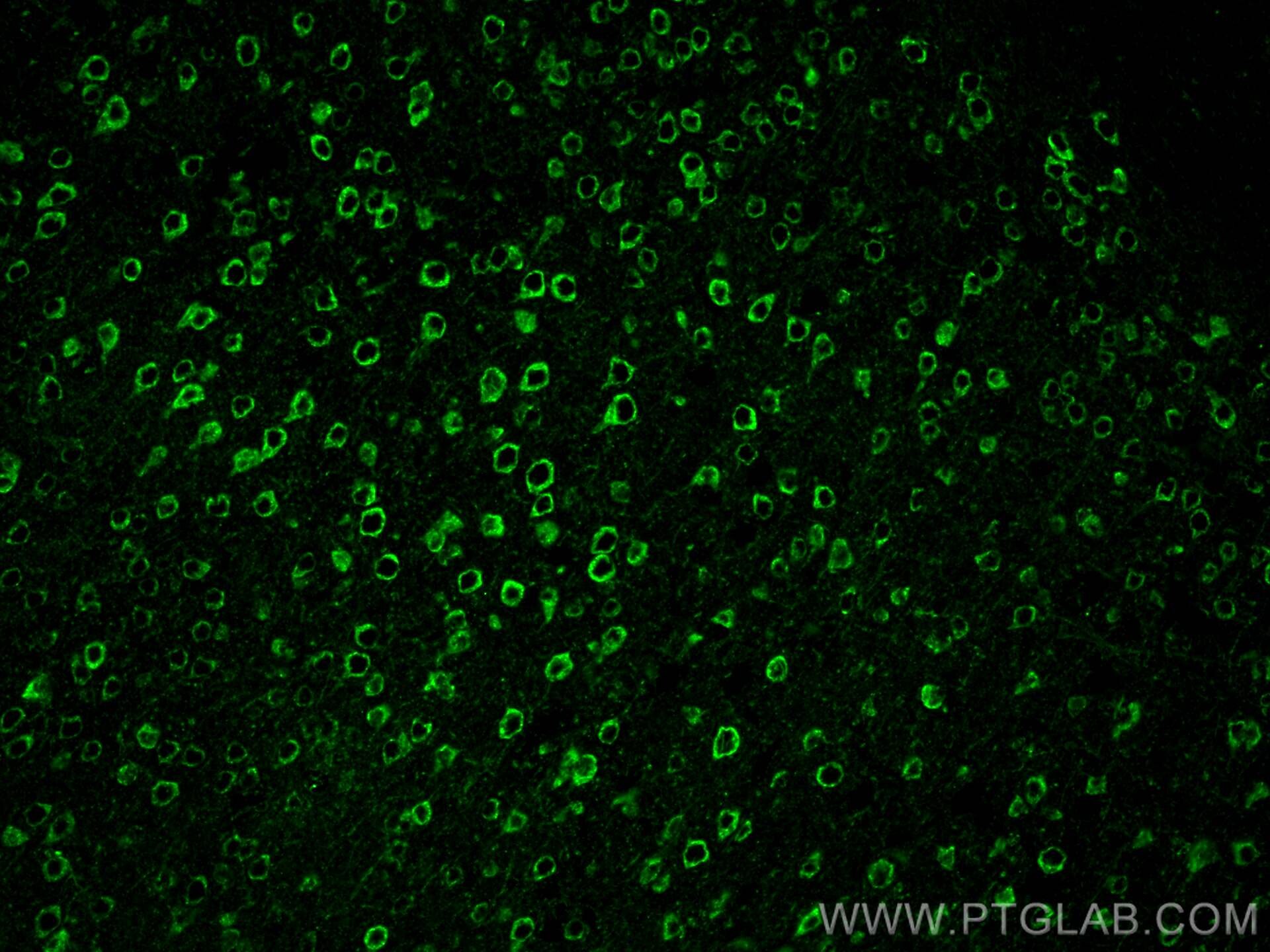 Immunofluorescent analysis of (4% PFA) fixed mouse brain tissue using PSD95-Specific,DLG4 antibody (81106-1-RR, Clone: 1I22 ) at dilution of 1:200 and CoraLite®488-Conjugated AffiniPure Goat Anti-Rabbit IgG(H+L).