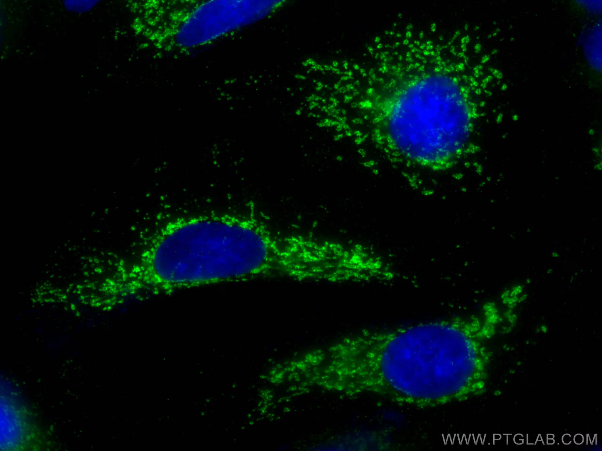 Immunofluorescent analysis of (-20°C Methanol) fixed A549 cells using GLS antibody (81486-1-RR, Clone: 4C20 ) at dilution of 1:1000 and CoraLite®488-Conjugated AffiniPure Goat Anti-Rabbit IgG(H+L) (SA00013-2).