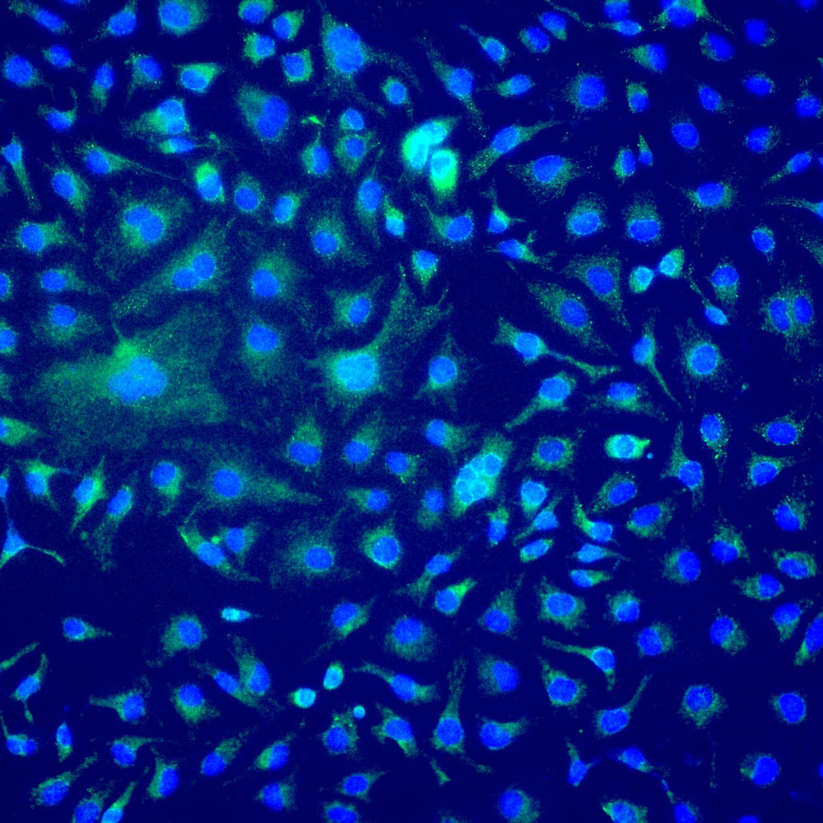 Immunofluorescent analysis of (4% PFA) fixed HeLa cells using ChemBright CoraLite® Plus 488 Antibody Conjugation Kit (PK30030) conjugated TOM20 Polyclonal antibody (11802-1-AP) at dilution of 1:500.