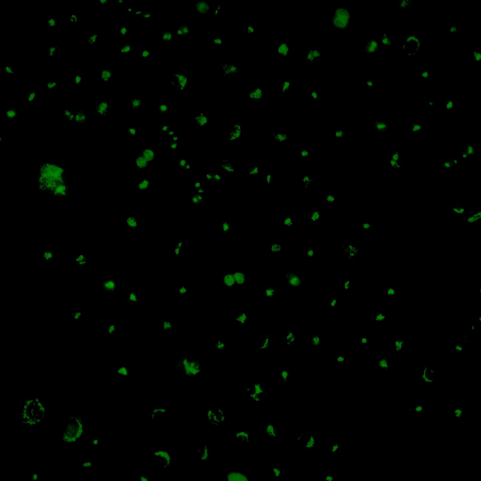 Immunofluorescent analysis of (4% PFA) fixed HeLa cells using ChemBright CoraLite® Plus 488 Antibody Conjugation Kit (PK30030) conjugated GOLGA2/GM130 Polyconal antibody (11308-1-AP) at dilution of 1:500.