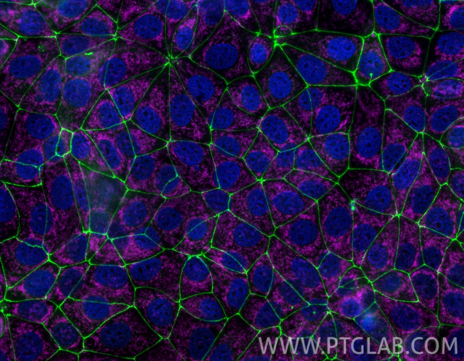 Immunofluorescence of MCF-7 cells: PFA-fixed cells were stained with anti-ZO-1 (21773-1-AP) with ChemBright CoraLite® Plus 488 Antibody Conjugation Kit (PK30030 green), anti-TOM 20 (80501-1-RR) with ChemBright CoraLite® Plus 647 Antibody Conjugation Kit (PK30031 magenta), anti-Histone H3 (68345-1-Ig) with ChemBright CoraLite® Plus 405 Antibody Conjugation Kit (PK30035 blue). Immunofluorescence of MCF-7 cells: PFA-fixed cells were stained with anti-ZO-1 (21773-1-AP) with ChemBright CoraLite® Plus 488 Antibody Conjugation Kit (PK30030 green), anti-TOM 20 (80501-1-RR) with ChemBright CoraLite® Plus 647 Antibody Conjugation Kit (PK30031 magenta), anti-Histone H3 (68345-1-Ig) with ChemBright CoraLite® Plus 405 Antibody Conjugation Kit (PK30035 blue).