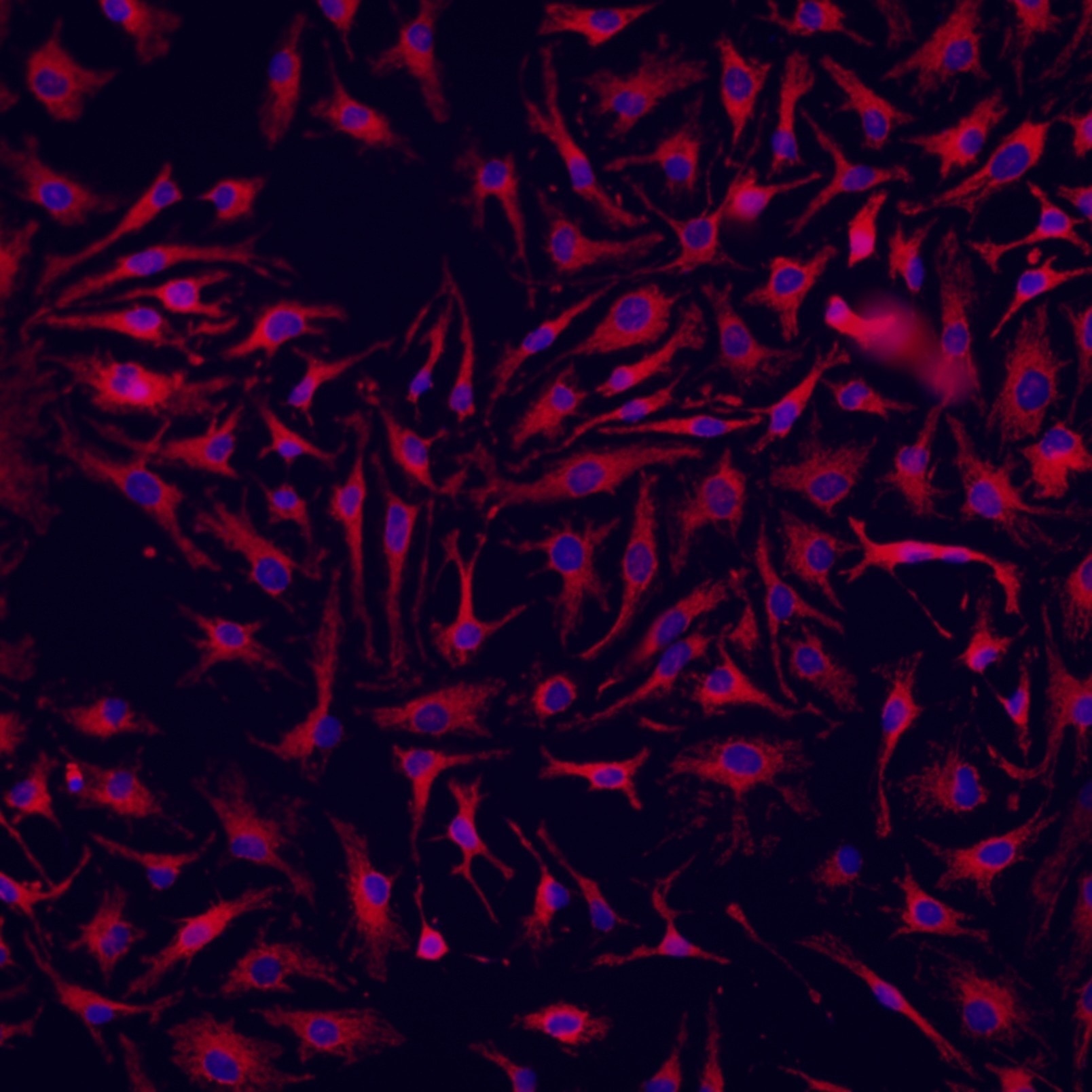 Immunofluorescent analysis of (4% PFA) fixed HeLa cells using ChemBright CoraLite® Plus 647 Antibody Conjugation Kit (PK30031) conjugated TOM20 Polyclonal antibody (11802-1-AP) at dilution of 1:500.