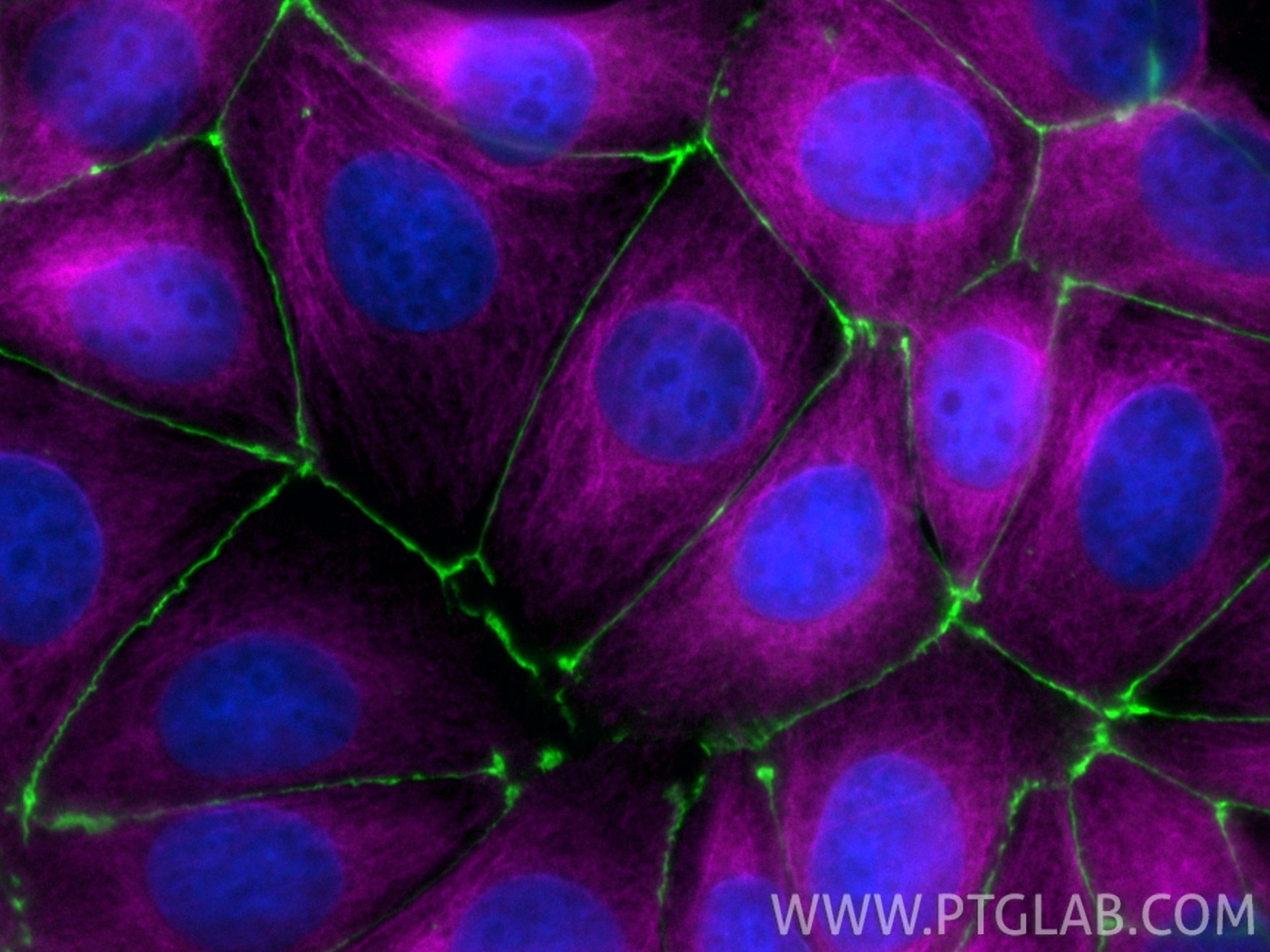 Immunofluorescence of MCF-7 cells: PFA-fixed cells were stained with anti-ZO-1 (21773-1-AP) labeled with Chembright Kit (PK30030 green), anti-Tubulin-Alpha (66031-1-Ig) labeled with Chembright Kit (PK30031 magenta). Cell nuclei were stained with DAPI (blue).