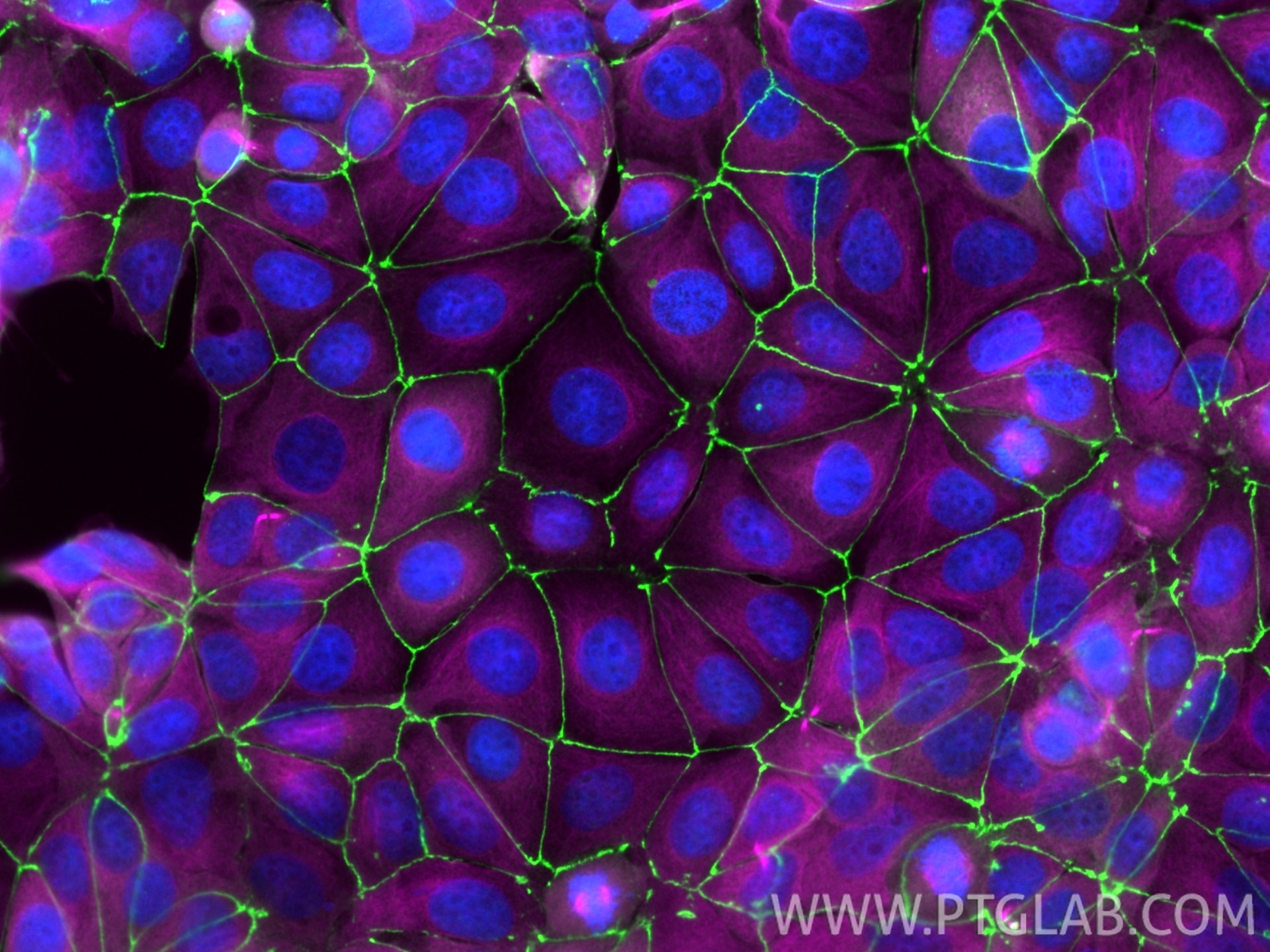 Immunofluorescence of MCF-7 cells: PFA-fixed cells were stained with anti-ZO-1 (21773-1-AP) labeled with Chembright Kit (PK30030 green), anti-Tubulin-Alpha (66031-1-Ig) labeled with Chembright Kit (PK30031 magenta). Cell nuclei were stained with DAPI (blue).