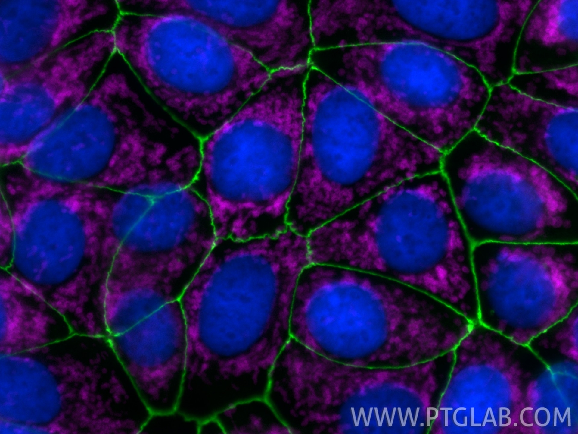 Immunofluorescence of MCF-7 cells: PFA-fixed cells were stained with anti-ZO-1 (21773-1-AP) labeled with Chembright Kit (PK30030 green), anti-TOM20 (80501-1-RR) labeled with Chembright Kit (PK30031 magenta). Cell nuclei were stained with DAPI (blue).