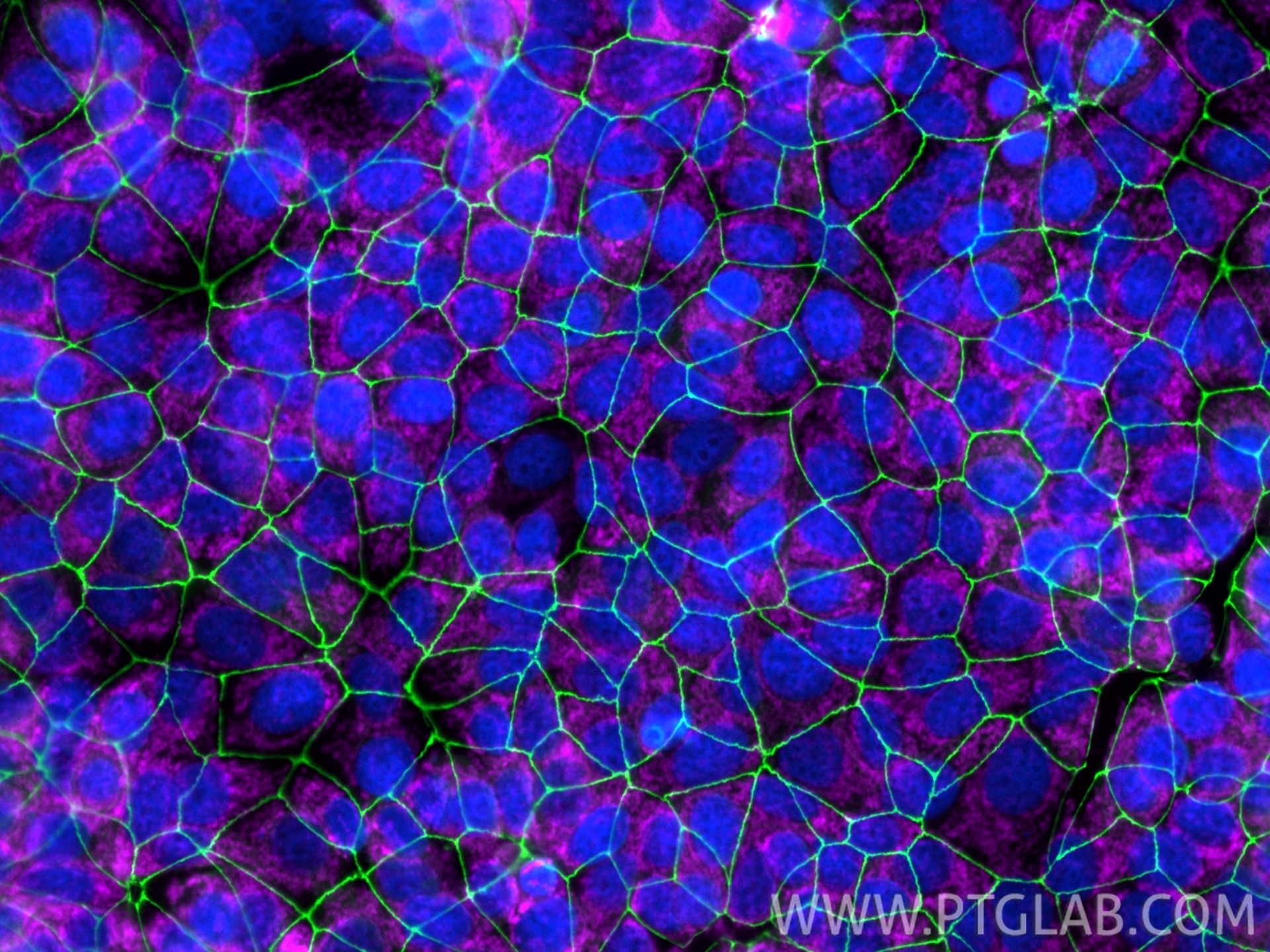Immunofluorescence of MCF-7 cells: PFA-fixed cells were stained with anti-ZO-1 (21773-1-AP) labeled with Chembright Kit (PK30030 green), anti-TOM20 (80501-1-RR) labeled with Chembright Kit (PK30031 magenta). Cell nuclei were stained with DAPI (blue).