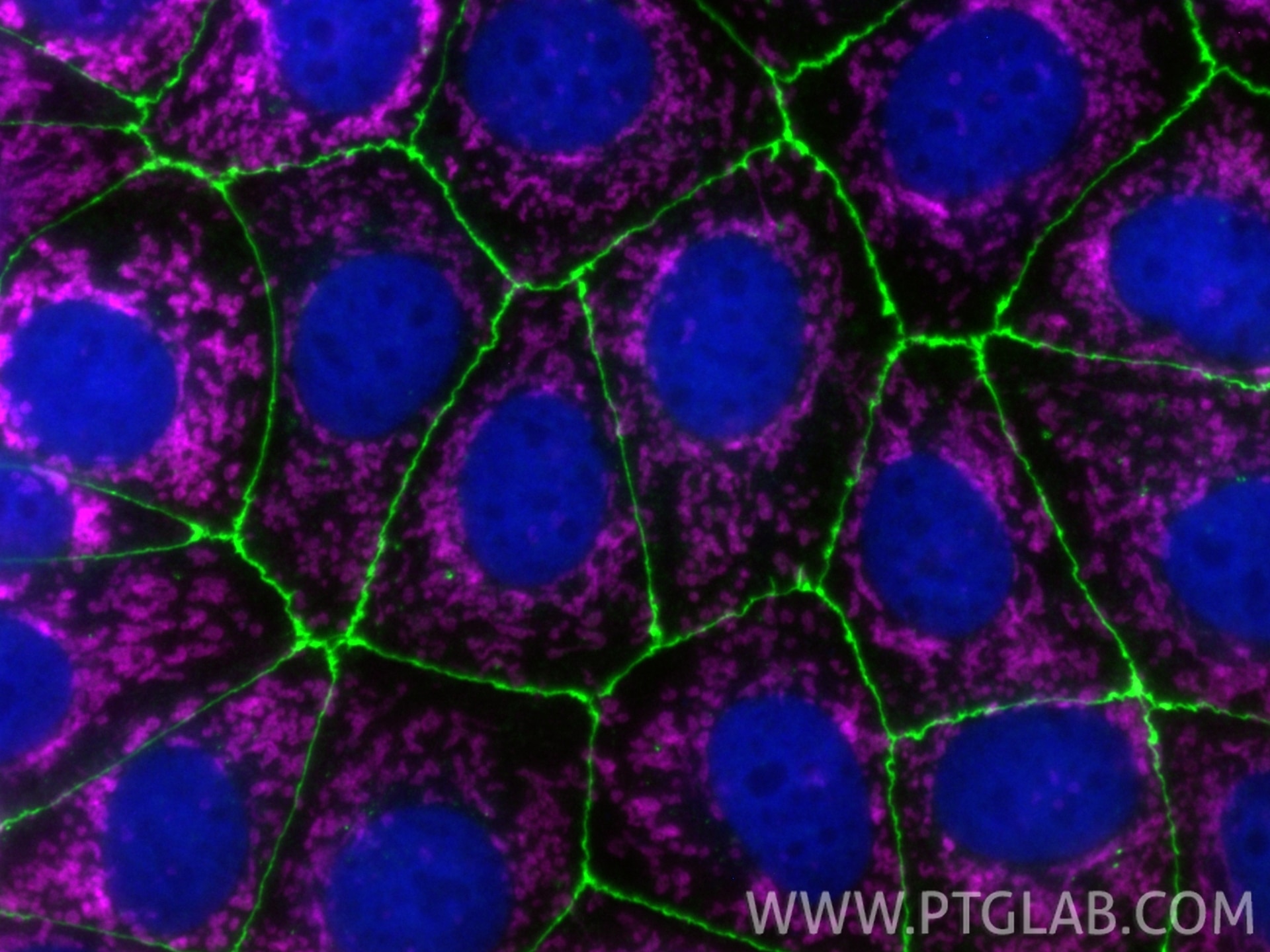 Immunofluorescence of MCF-7 cells: PFA-fixed cells were stained with anti-ZO-1 (21773-1-AP) with ChemBright CoraLite® Plus 488 Antibody Conjugation Kit (PK30030 green), anti-TOM 20 (80501-1-RR) with ChemBright CoraLite® Plus 647 Antibody Conjugation Kit (PK30031 magenta), anti-Histone H3 (68345-1-Ig) with ChemBright CoraLite® Plus 405 Antibody Conjugation Kit (PK30035 blue).