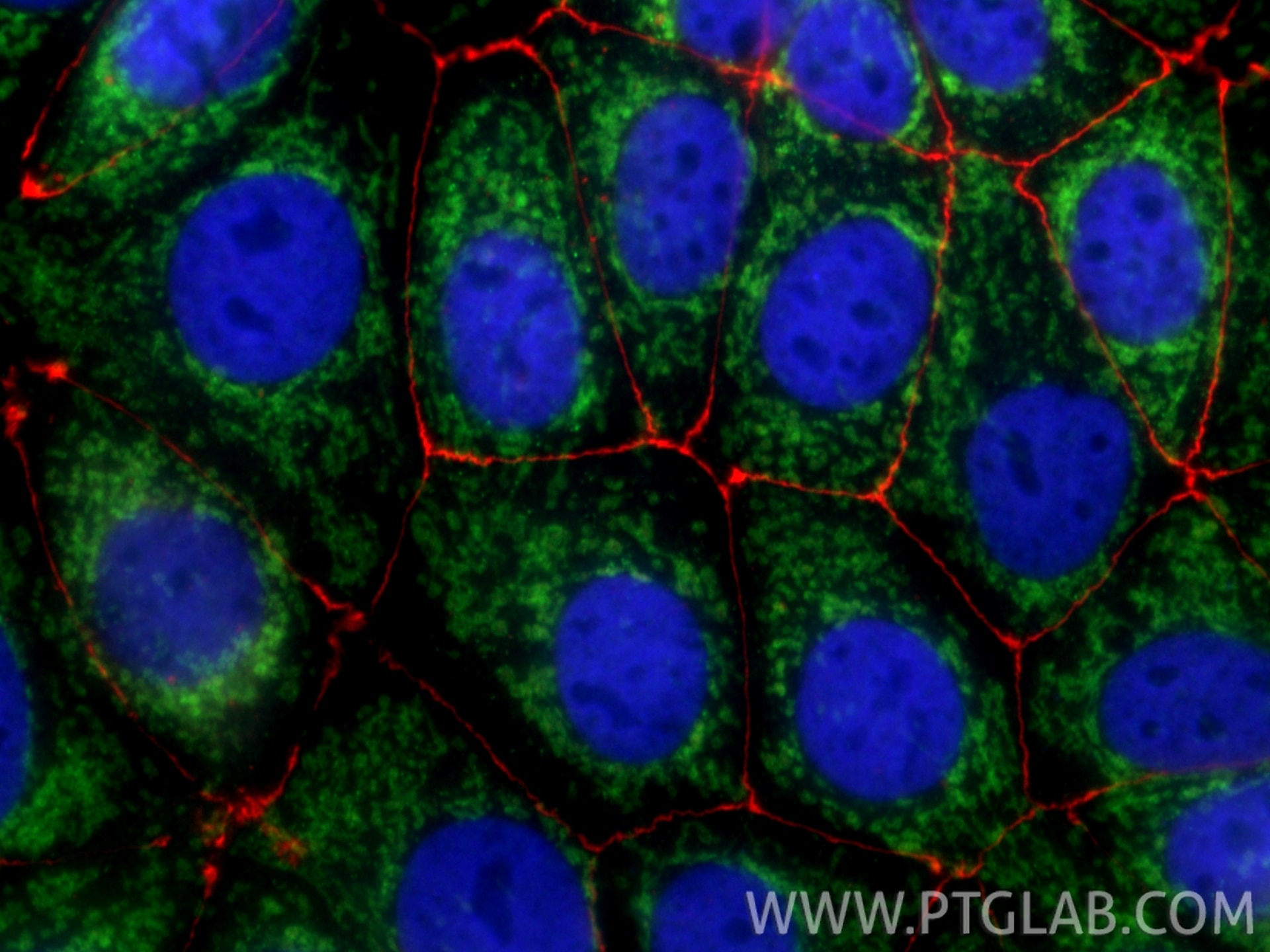 Immunofluorescence of MCF-7 cells: PFA-fixed cells were stained with anti-TOM20 (11802-1-AP) with ChemBright FITC Plus Antibody Conjugation Kit (PK30032 green), anti-ZO-1 (21773-1-AP) with ChemBright Biotin (PK30033) and Steptavidin-594 (red), anti-Histone H3 (68345-1-Ig) with ChemBright CoraLite® Plus 405 Antibody Conjugation Kit (PK30035 blue).