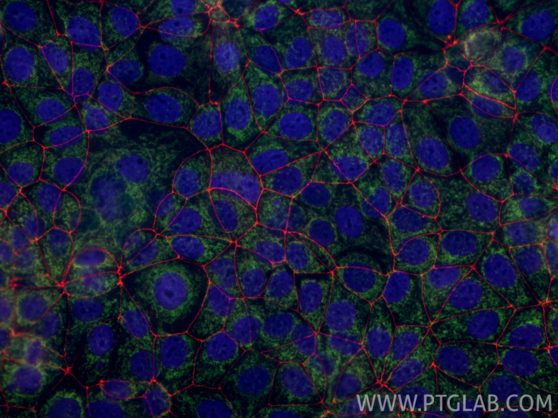 Immunofluorescence of MCF-7 cells: PFA-fixed cells were stained with anti-TOM20 (11802-1-AP) with ChemBright FITC Plus Antibody Conjugation Kit (PK30032 green), anti-ZO-1 (21773-1-AP) with ChemBright Biotin (PK30033) and Steptavidin-594 (red), anti-Histone H3 (68345-1-Ig) with ChemBright CoraLite® Plus 405 Antibody Conjugation Kit (PK30035 blue).