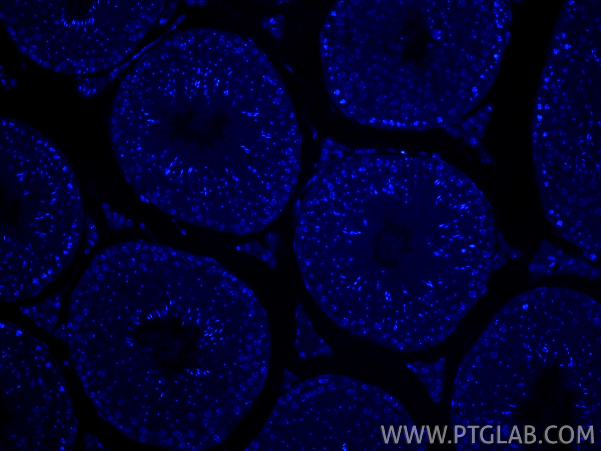 Immunofluorescent analysis of (4% PFA) fixed paraffin-embedded mouse testis tissue using DAPI. Heat mediated antigen retrieval with Tris-EDTA buffer (pH 9.0).