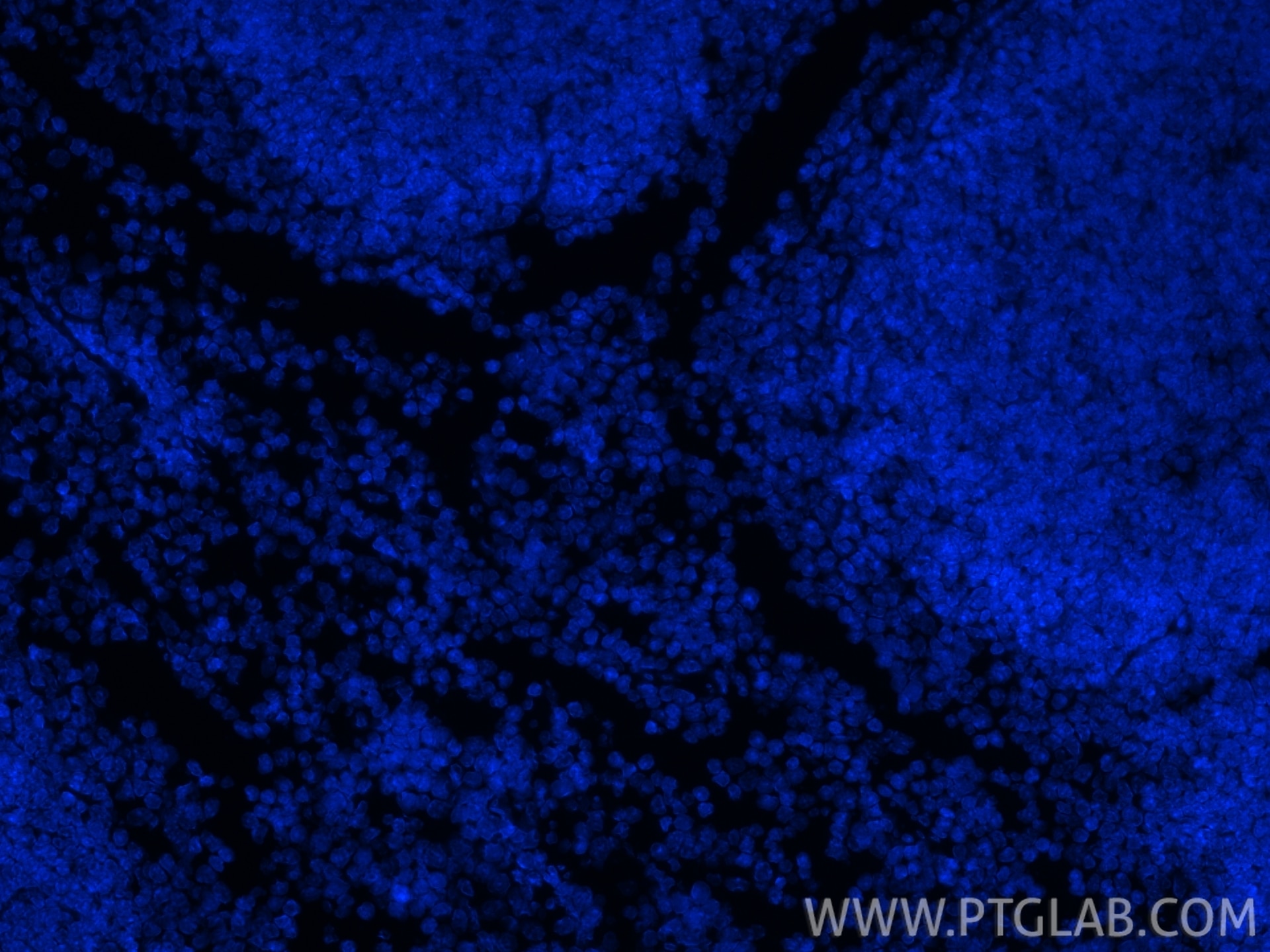 Immunofluorescent analysis of (4% PFA) fixed paraffin-embedded mouse spleen tissue using DAPI. Heat mediated antigen retrieval with Tris-EDTA buffer (pH 9.0).