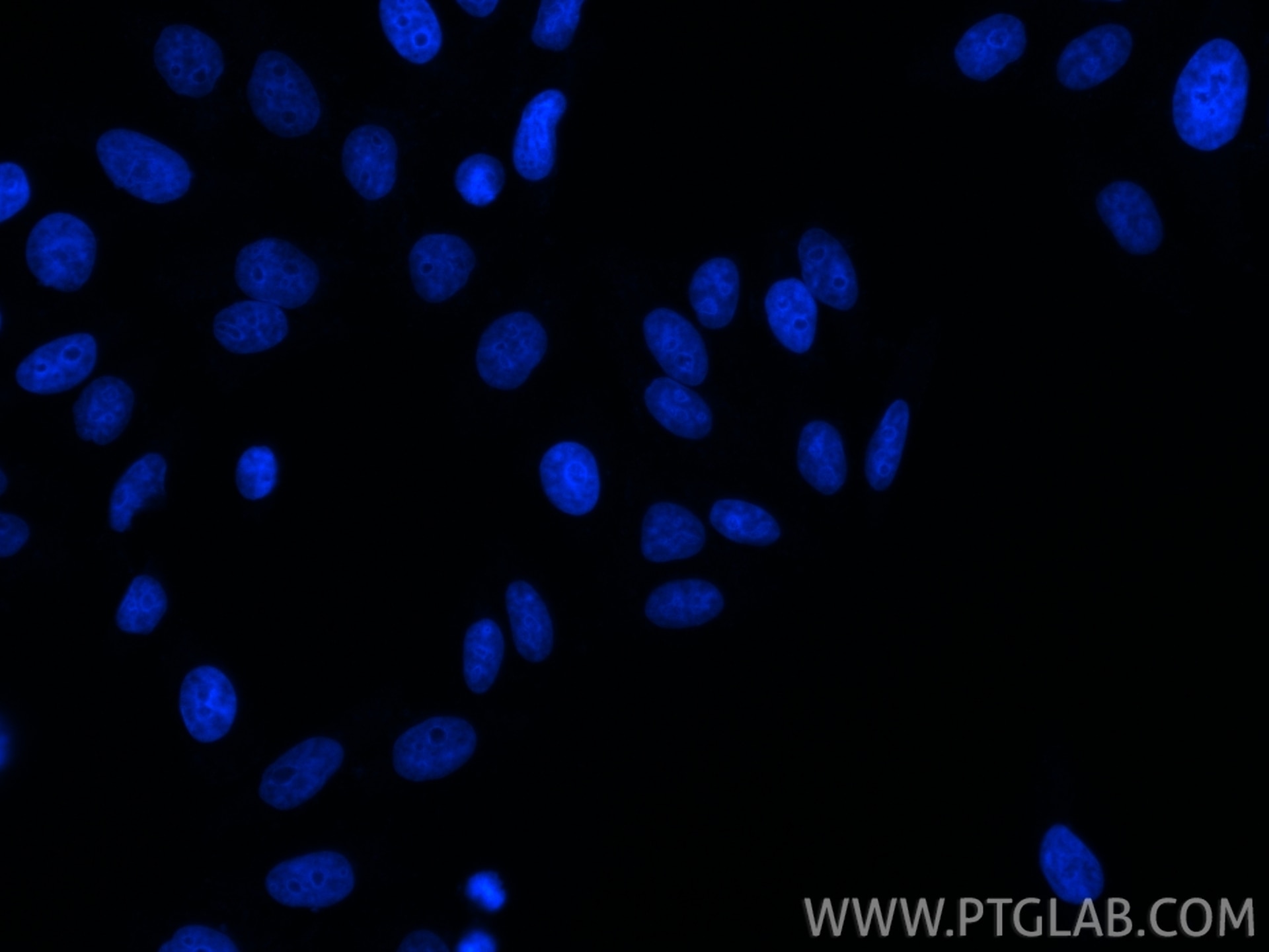 Immunofluorescent analysis of (4% PFA) fixed HepG2 cells using DAPI.