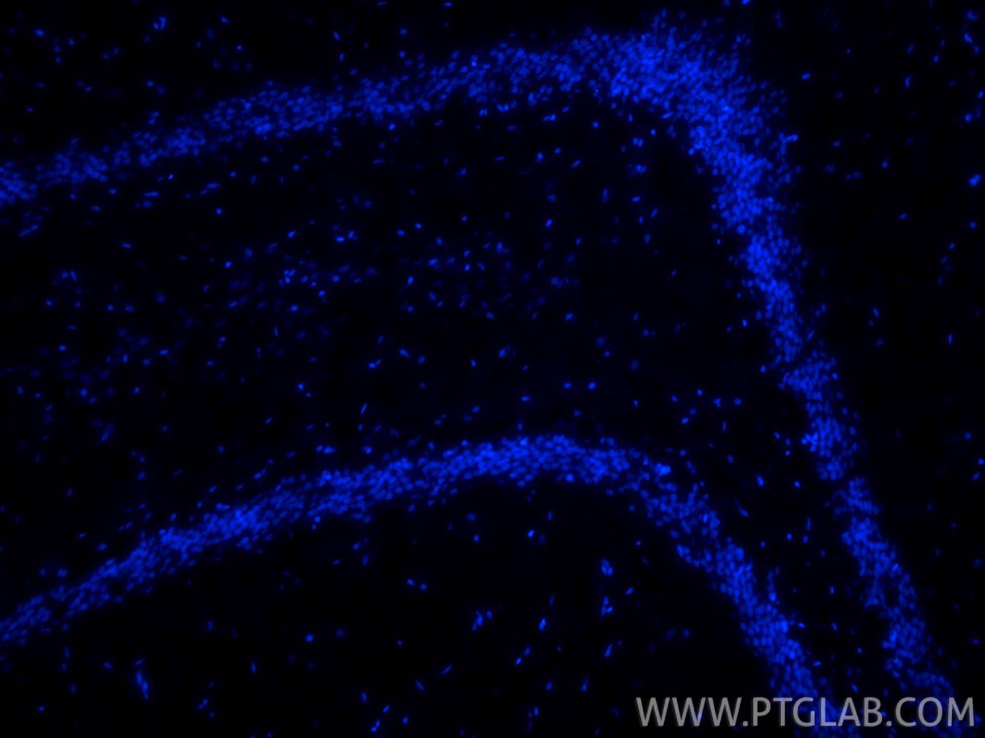 Immunofluorescent analysis of (4% PFA) fixed frozen OCT-embedded rat brain tissue using DAPI (PR30021).